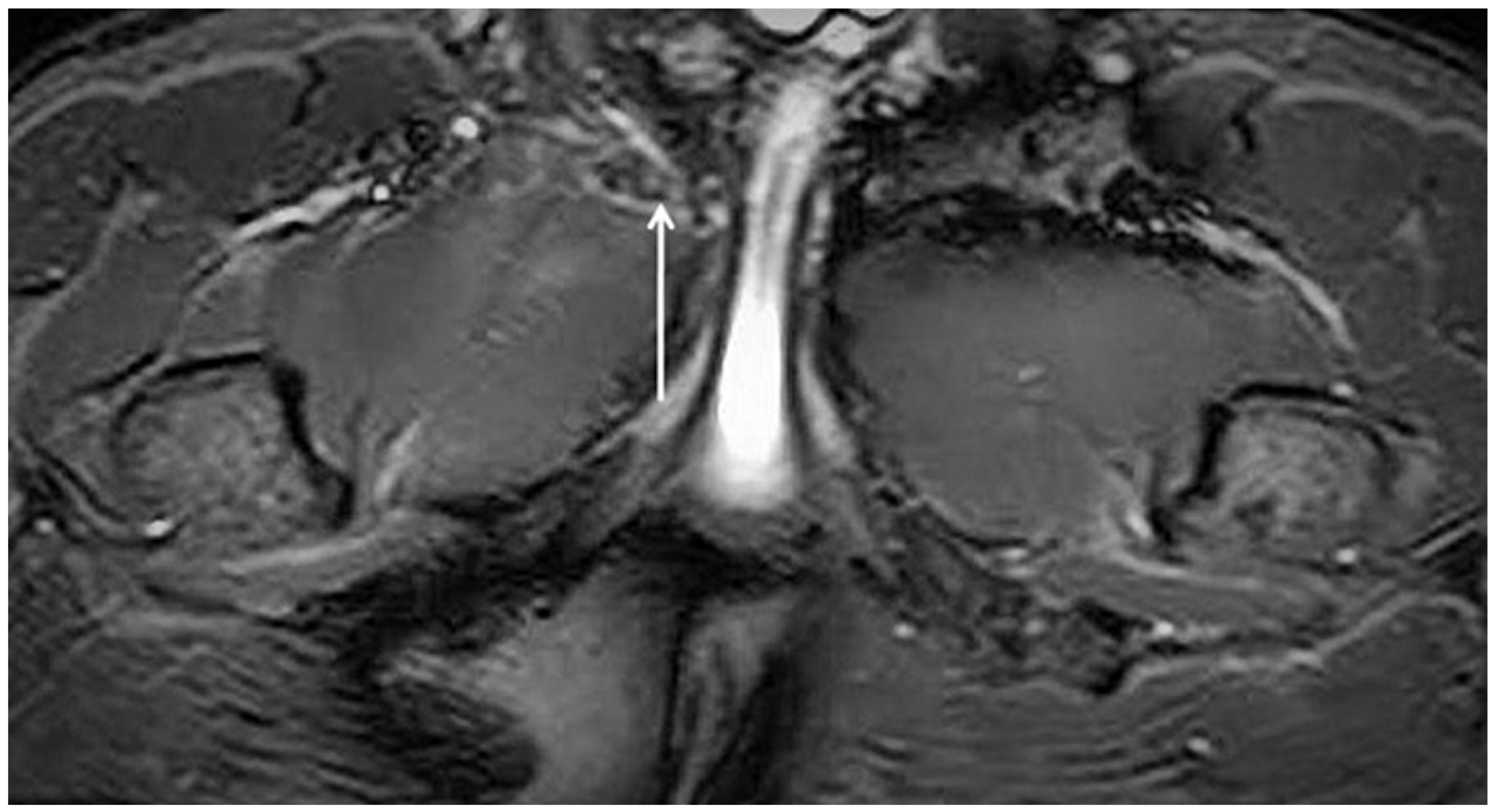 Diagnostics 15 00785 g009