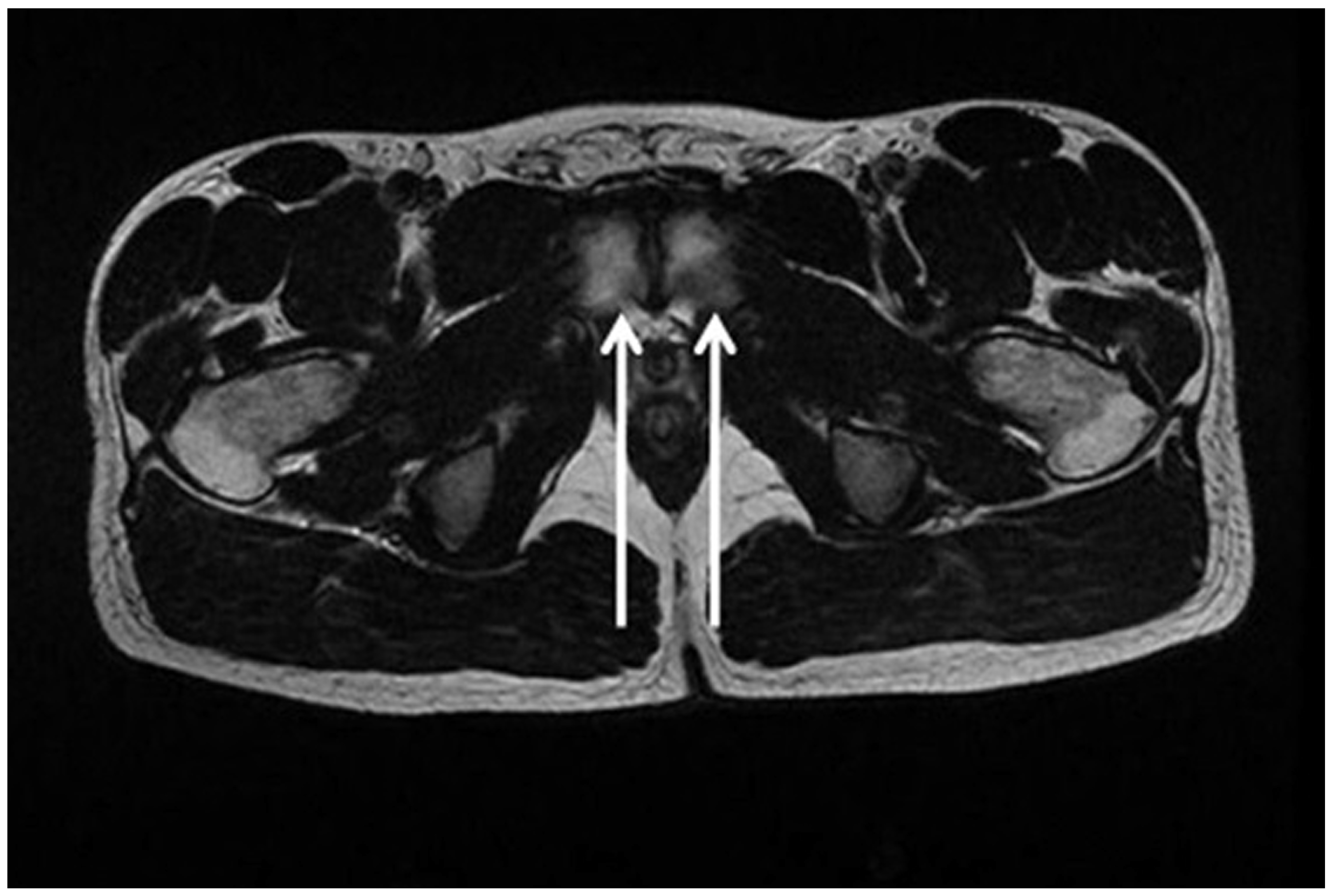 Diagnostics 15 00785 g011