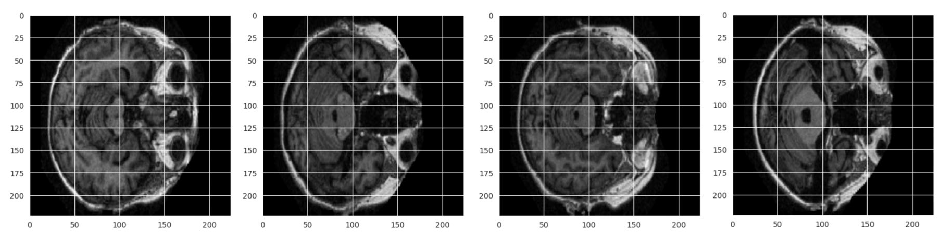 Diagnostics 15 00789 g003