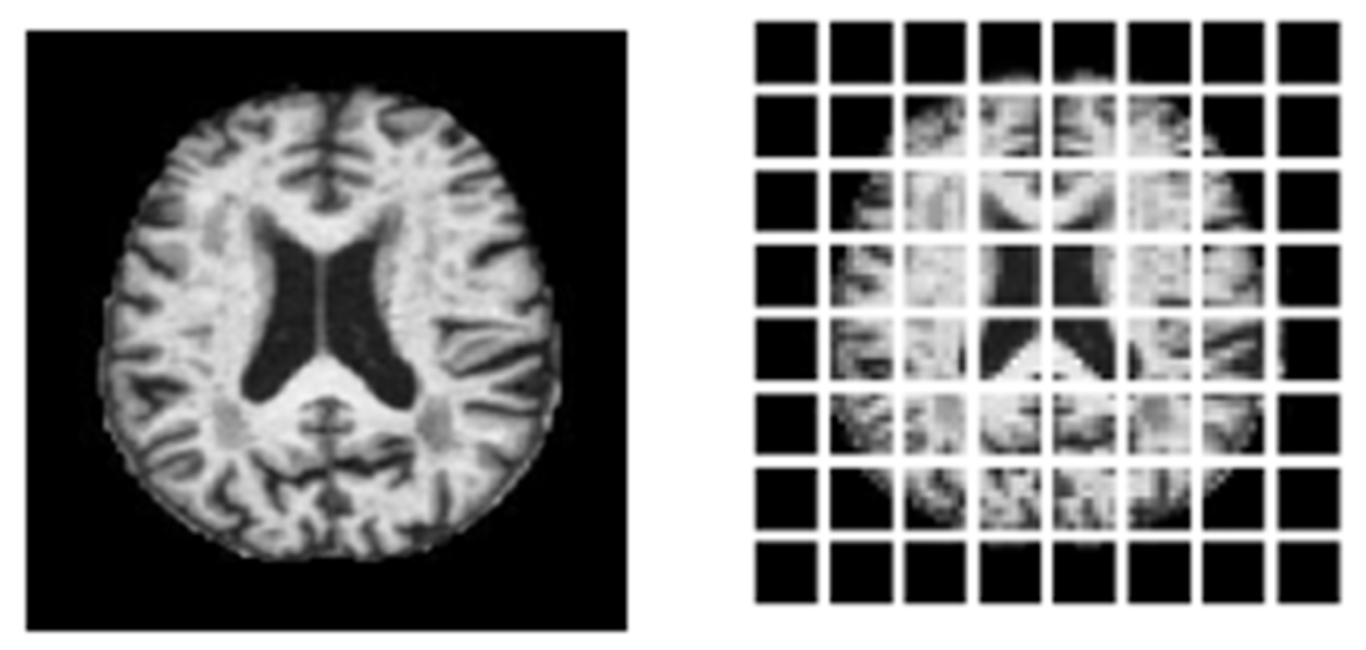 Diagnostics 15 00789 g011