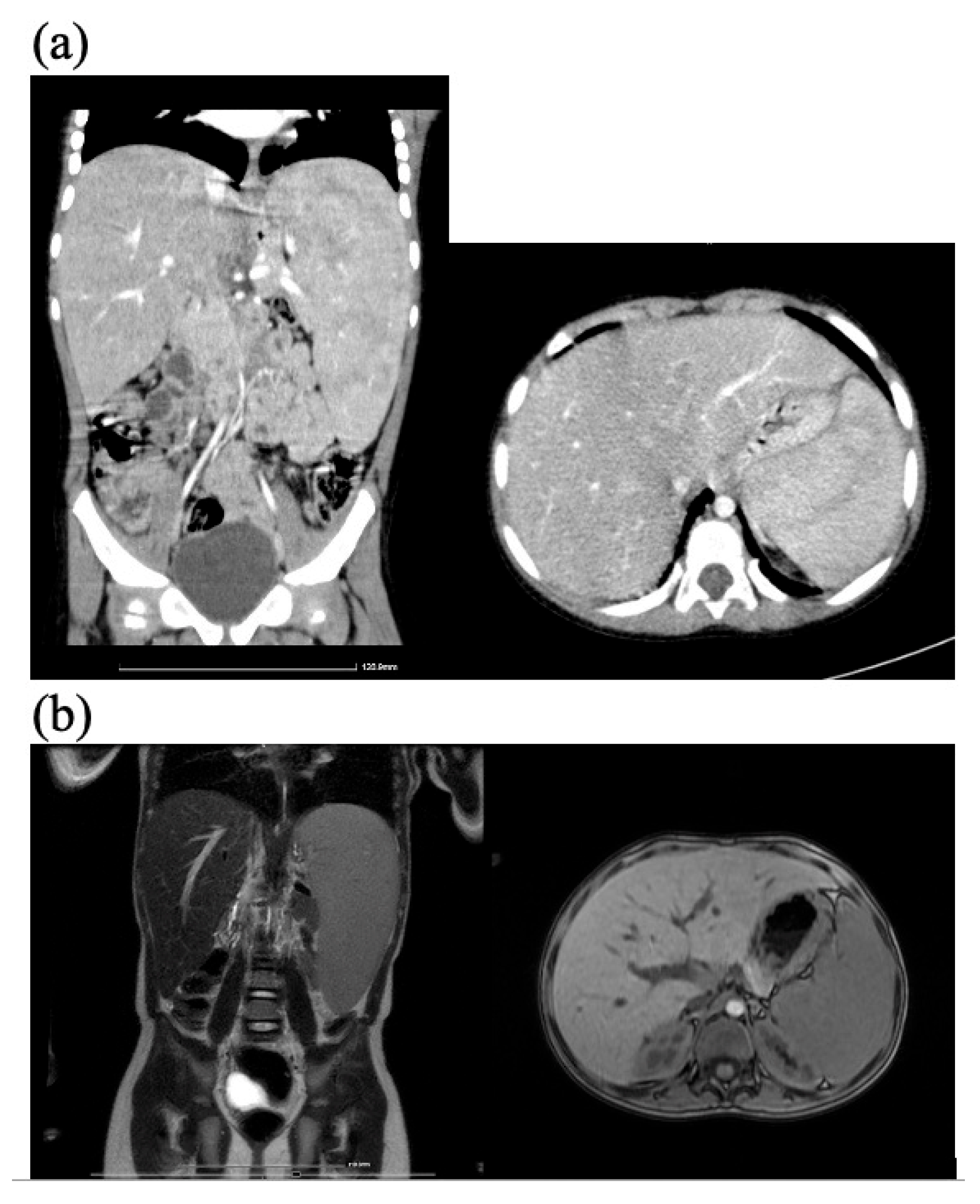 Diagnostics 15 00804 g004
