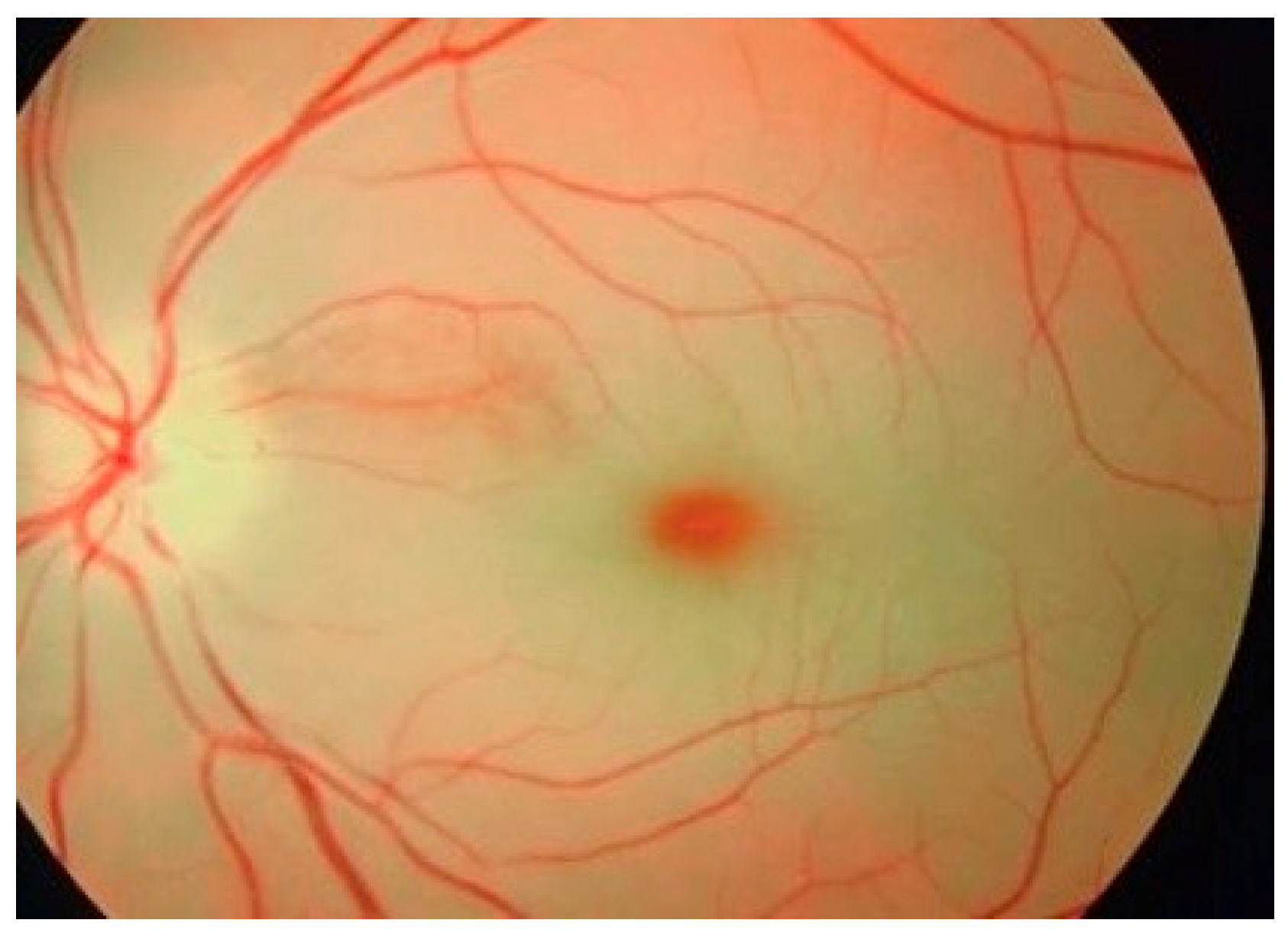 Diagnostics 15 00804 g006