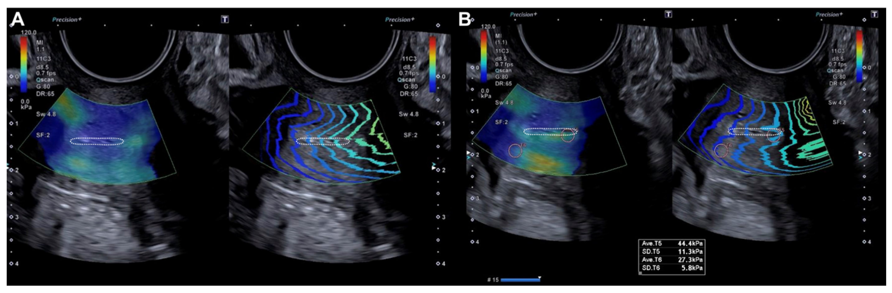 Diagnostics 15 00806 g002