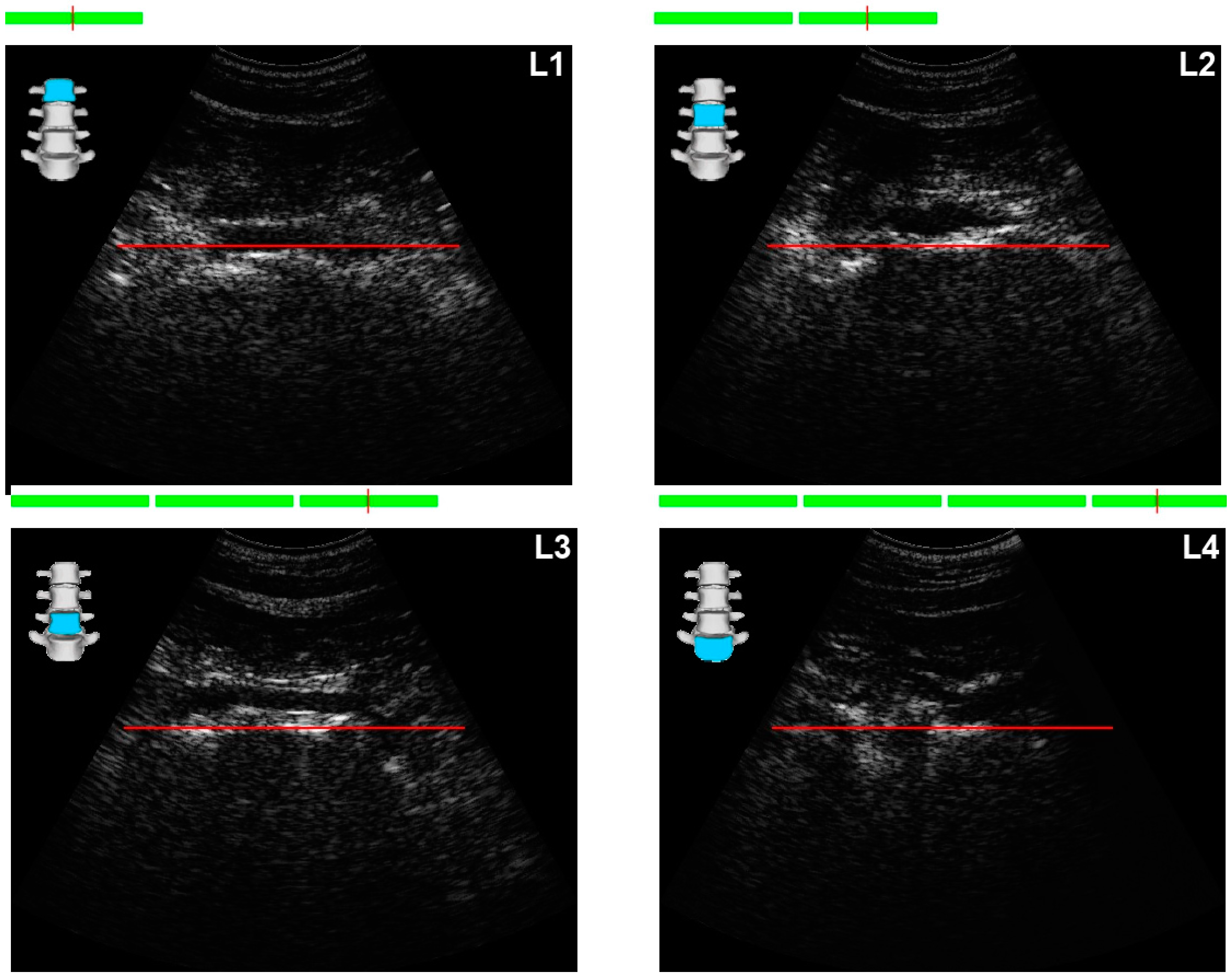 Diagnostics 15 00808 g002
