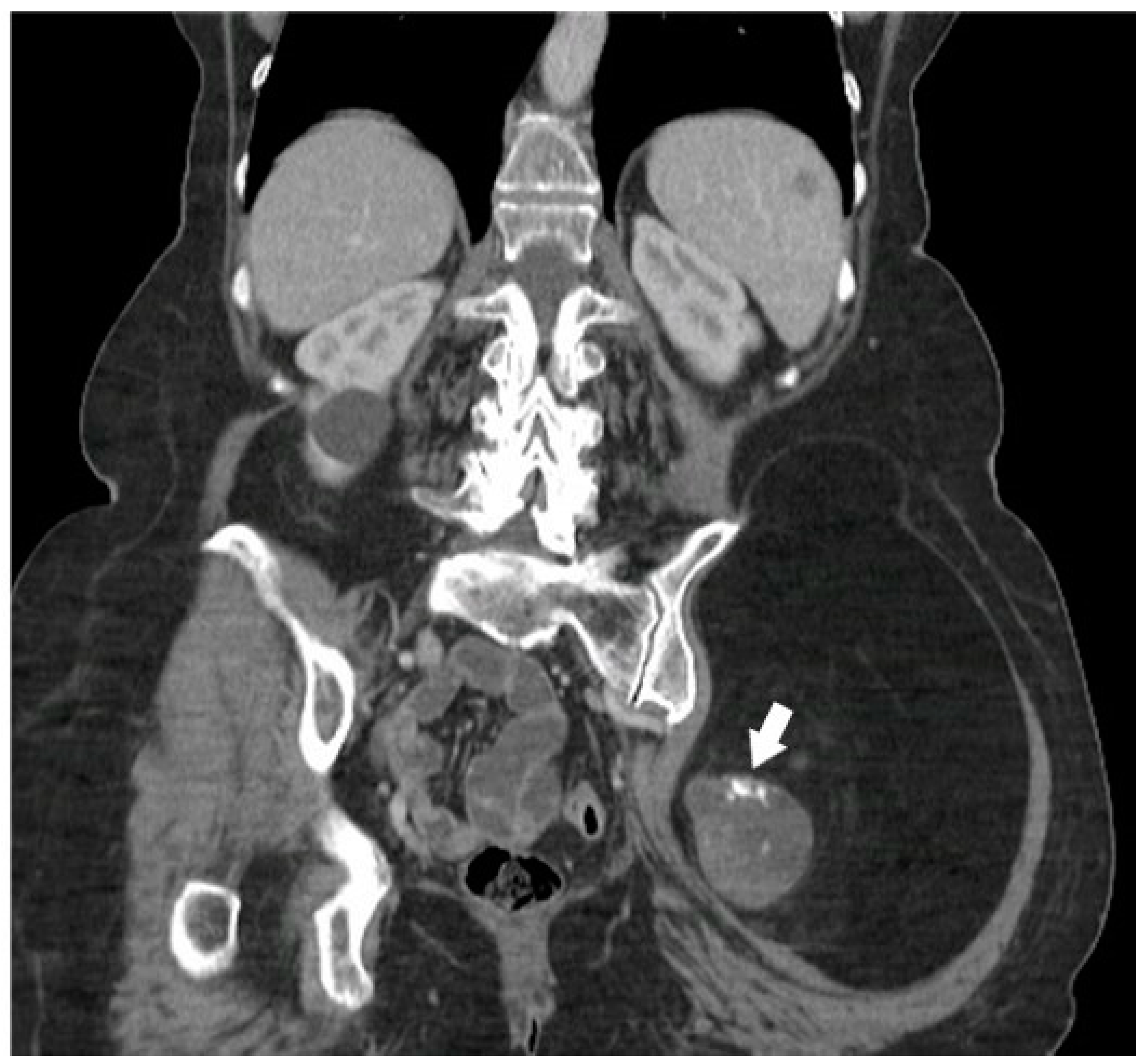 Diagnostics 15 00811 g003 Diagnostics 15 00811 g003