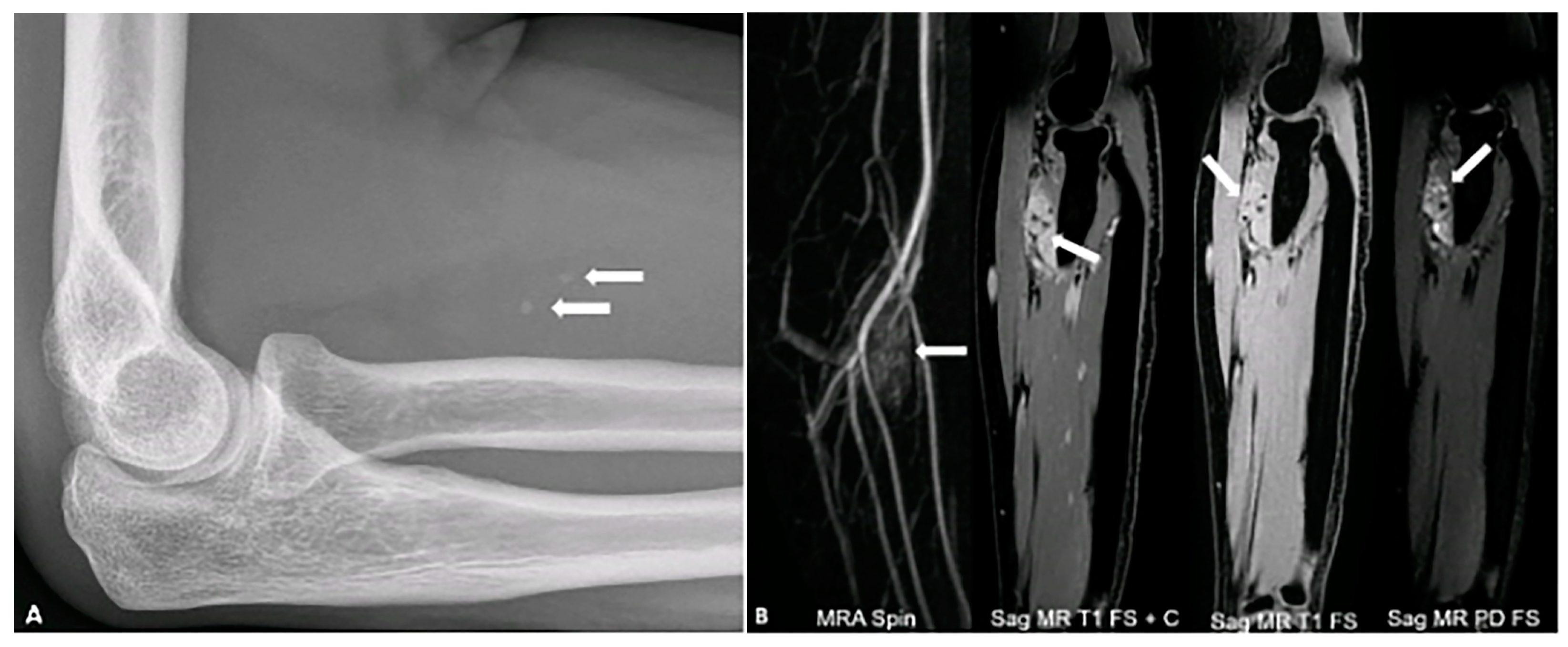 Diagnostics 15 00811 g004 Diagnostics 15 00811 g004