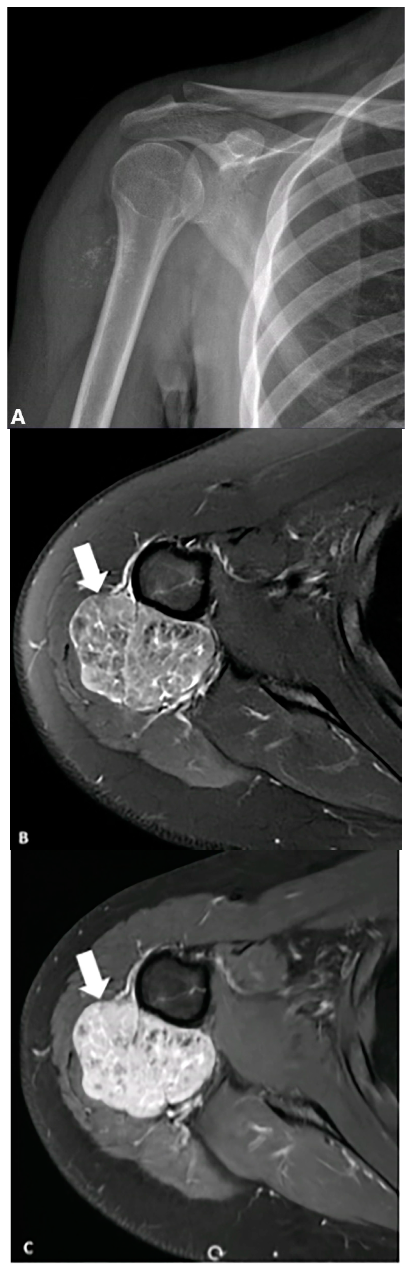 Diagnostics 15 00811 g005 Diagnostics 15 00811 g005
