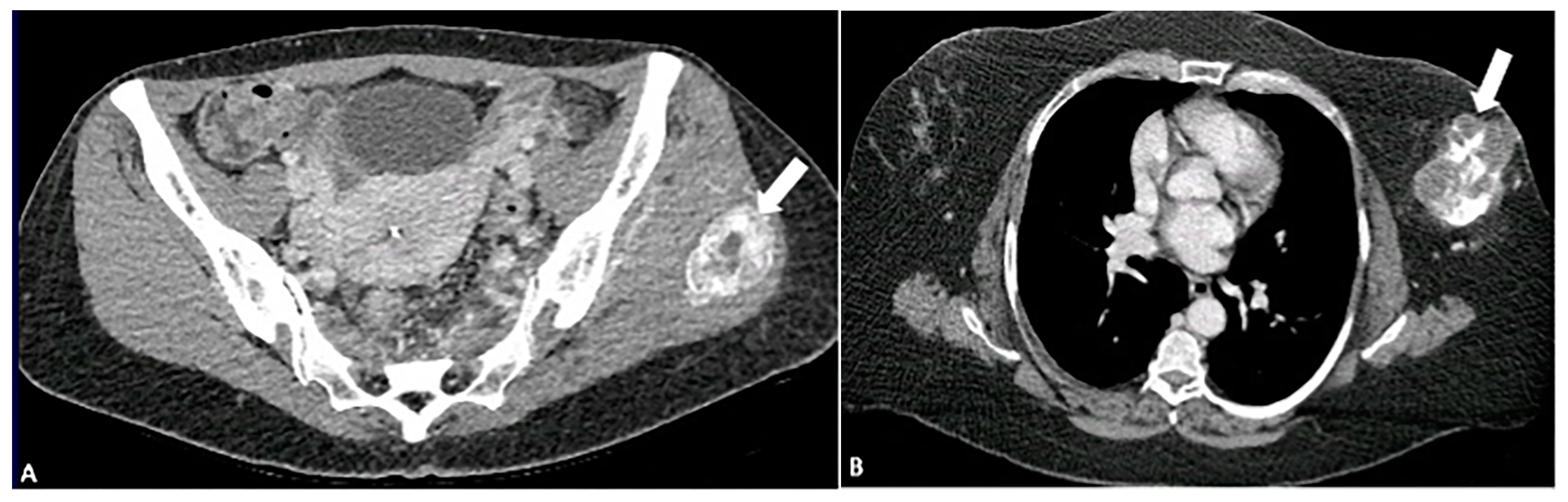 Diagnostics 15 00811 g006 Diagnostics 15 00811 g006