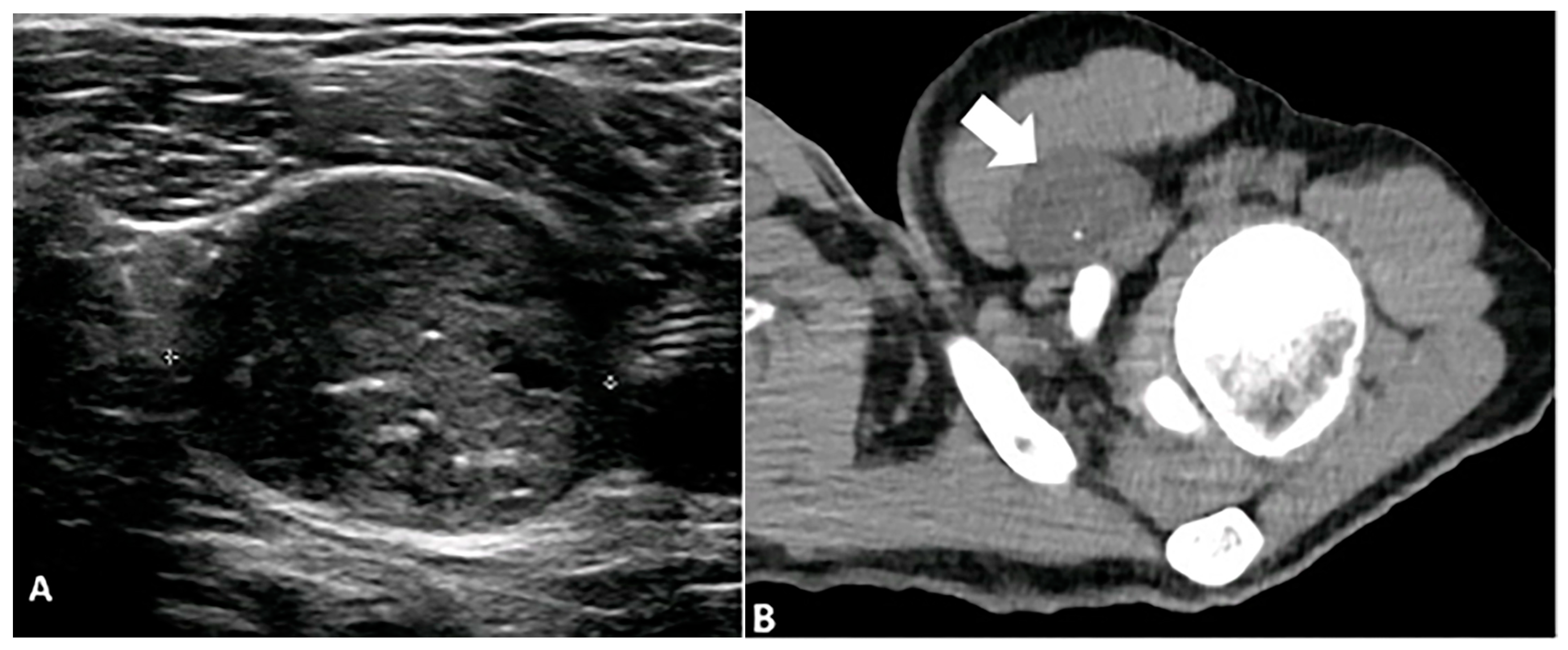 Diagnostics 15 00811 g009 Diagnostics 15 00811 g009