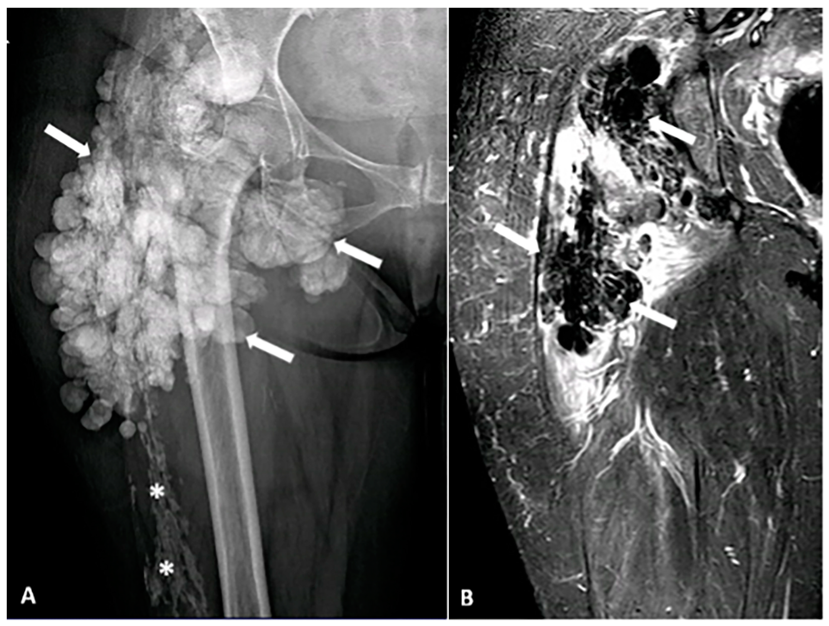 Diagnostics 15 00811 g010 Diagnostics 15 00811 g010