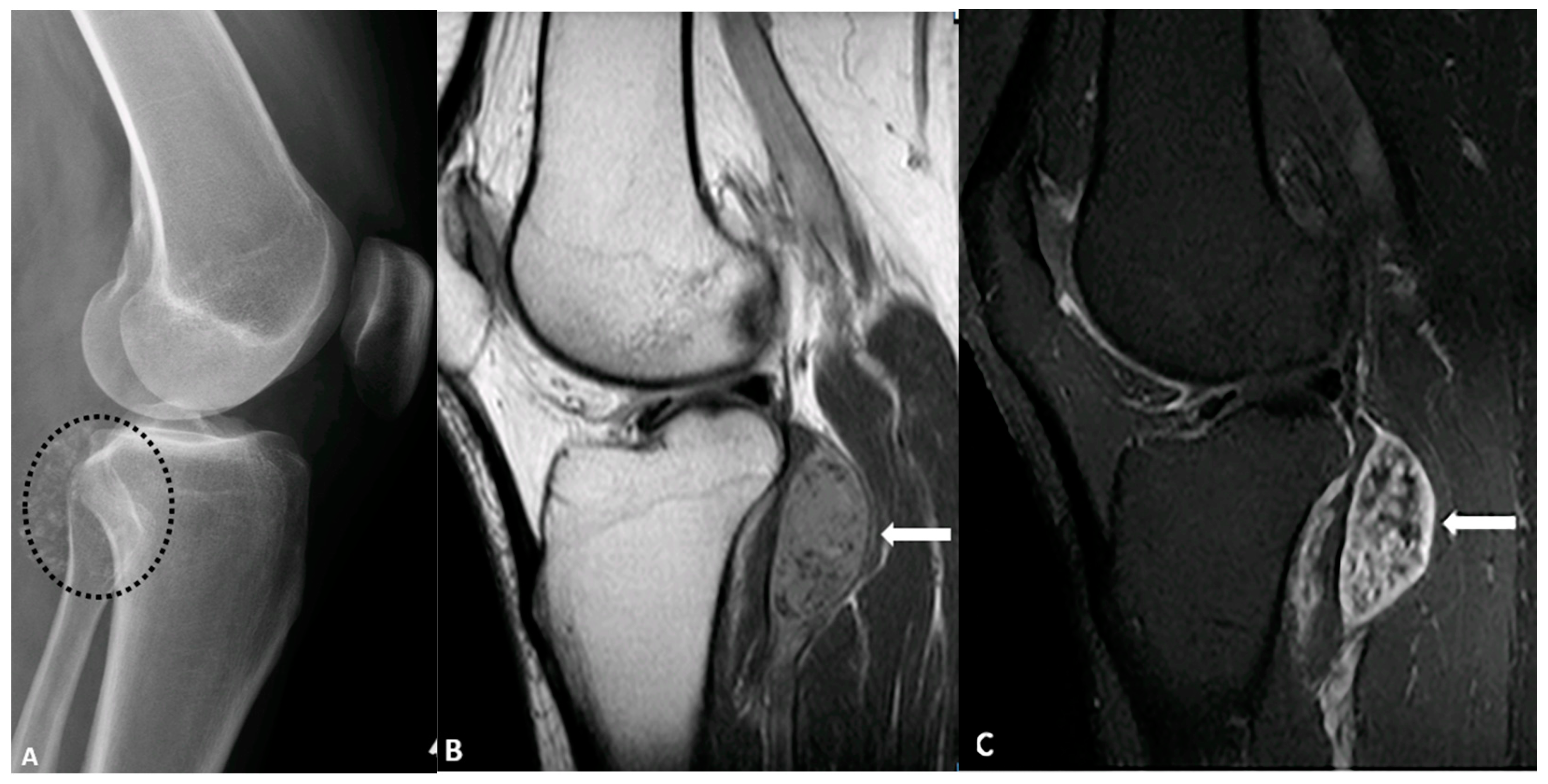 Diagnostics 15 00811 g011 Diagnostics 15 00811 g011