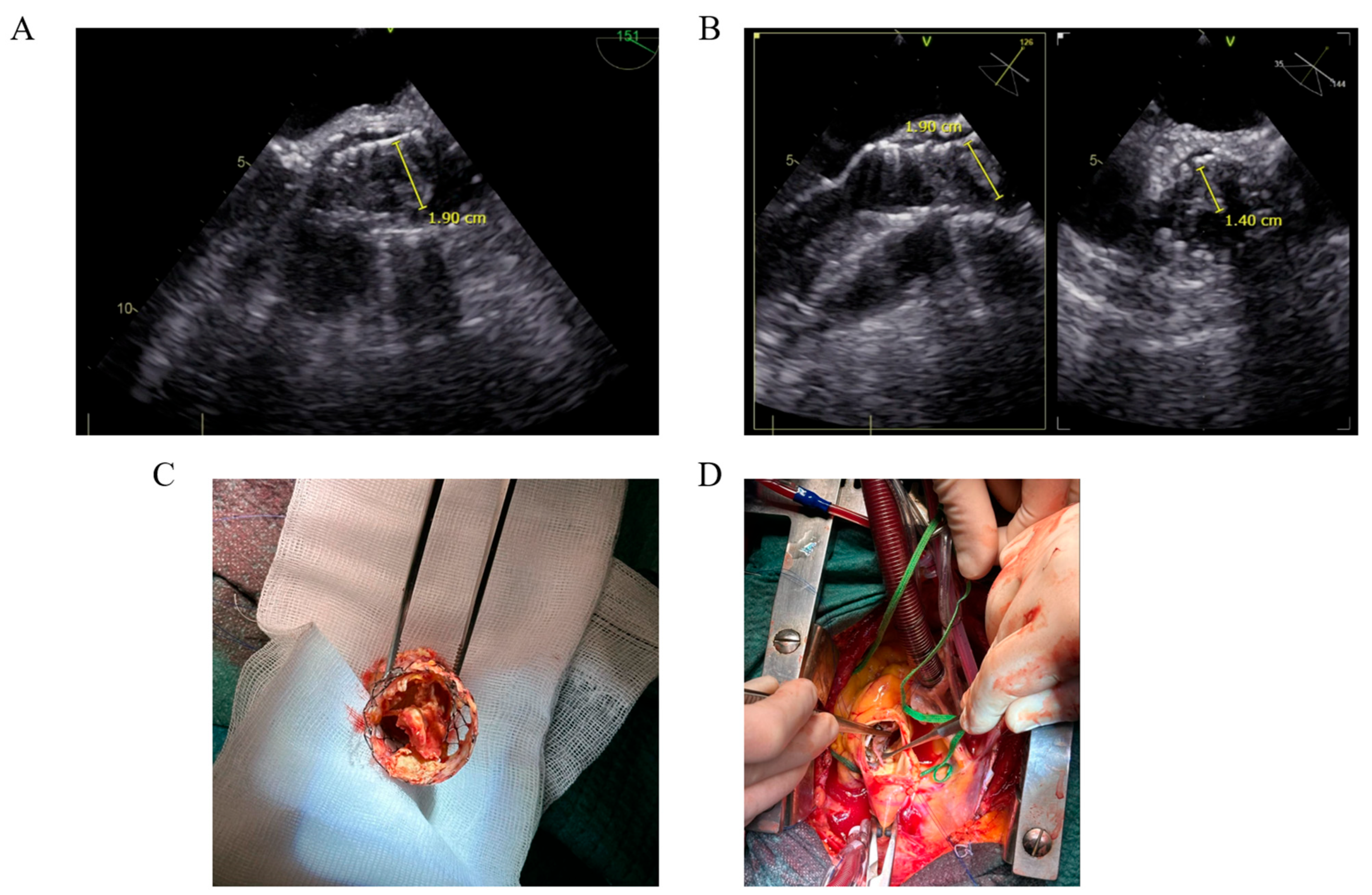 Diagnostics 15 00814 g001