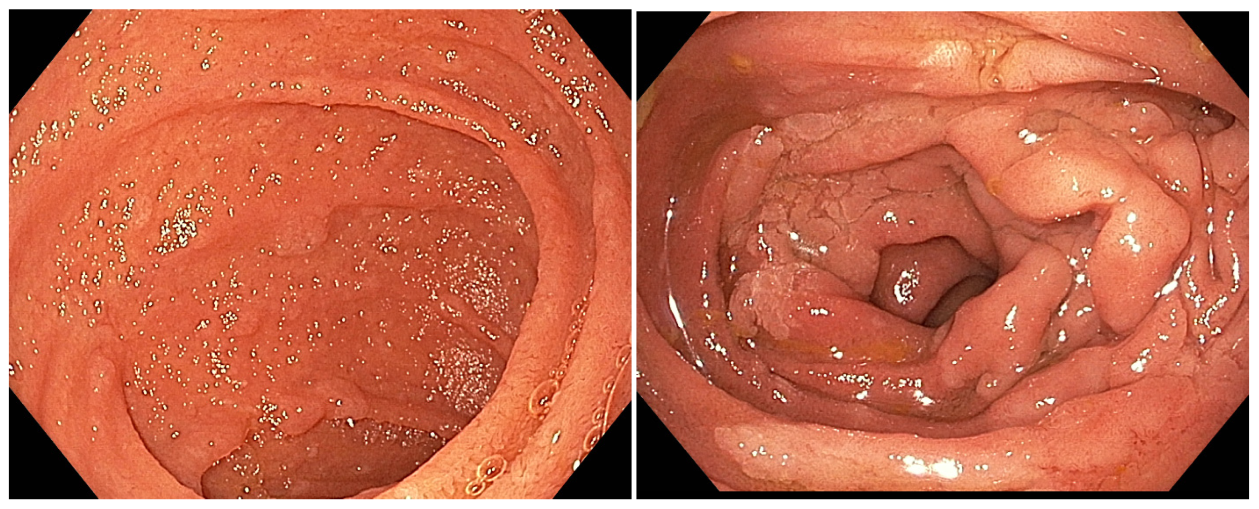 Diagnostics 15 00819 g001 Diagnostics 15 00819 g001