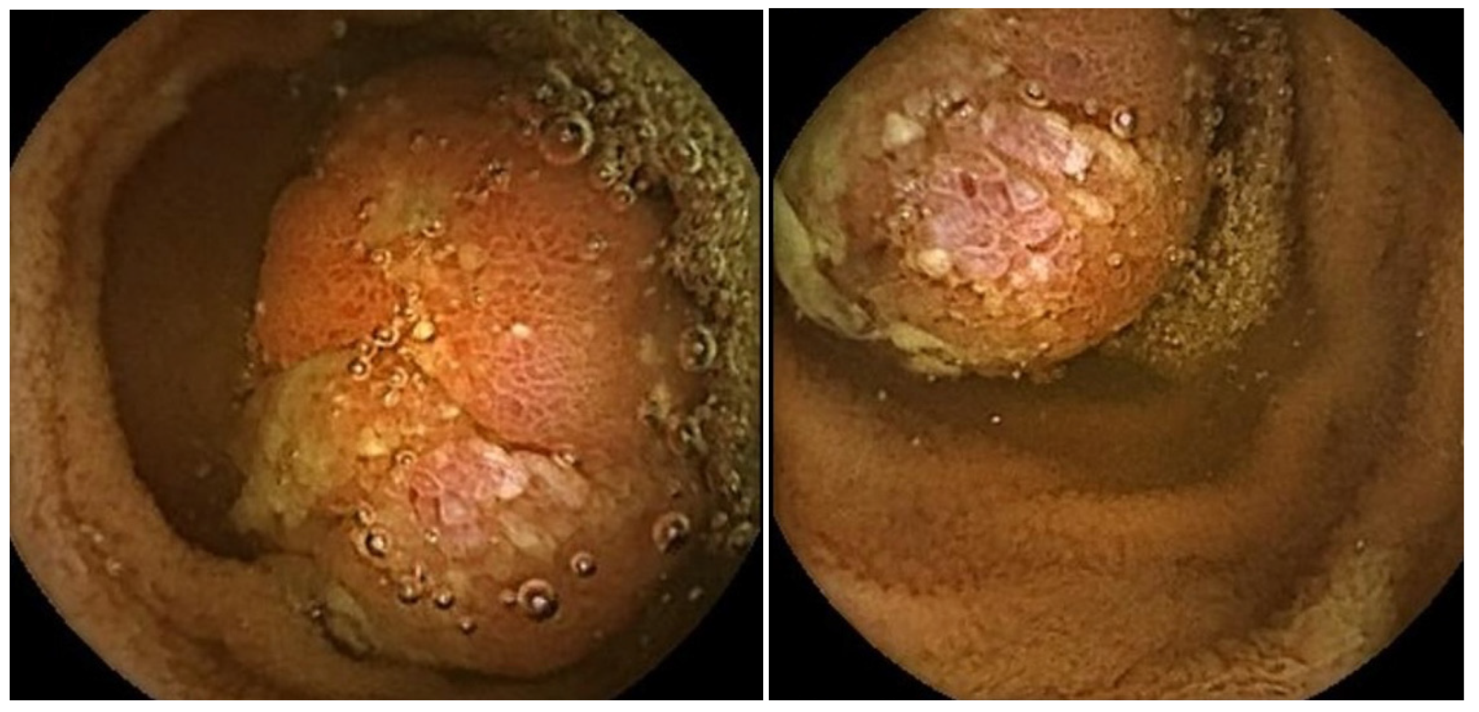 Diagnostics 15 00819 g004 Diagnostics 15 00819 g004