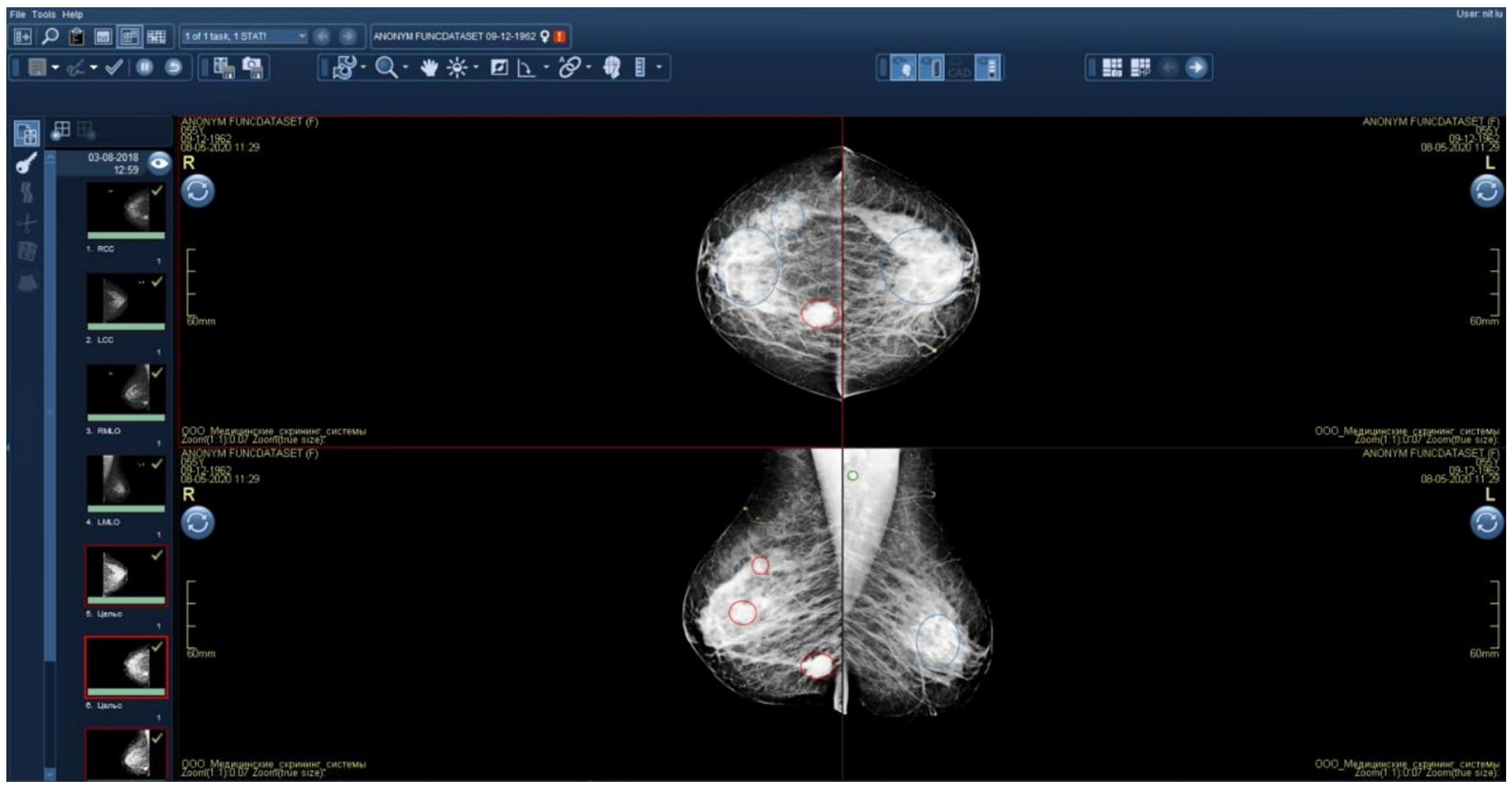 Diagnostics 15 00822 g004
