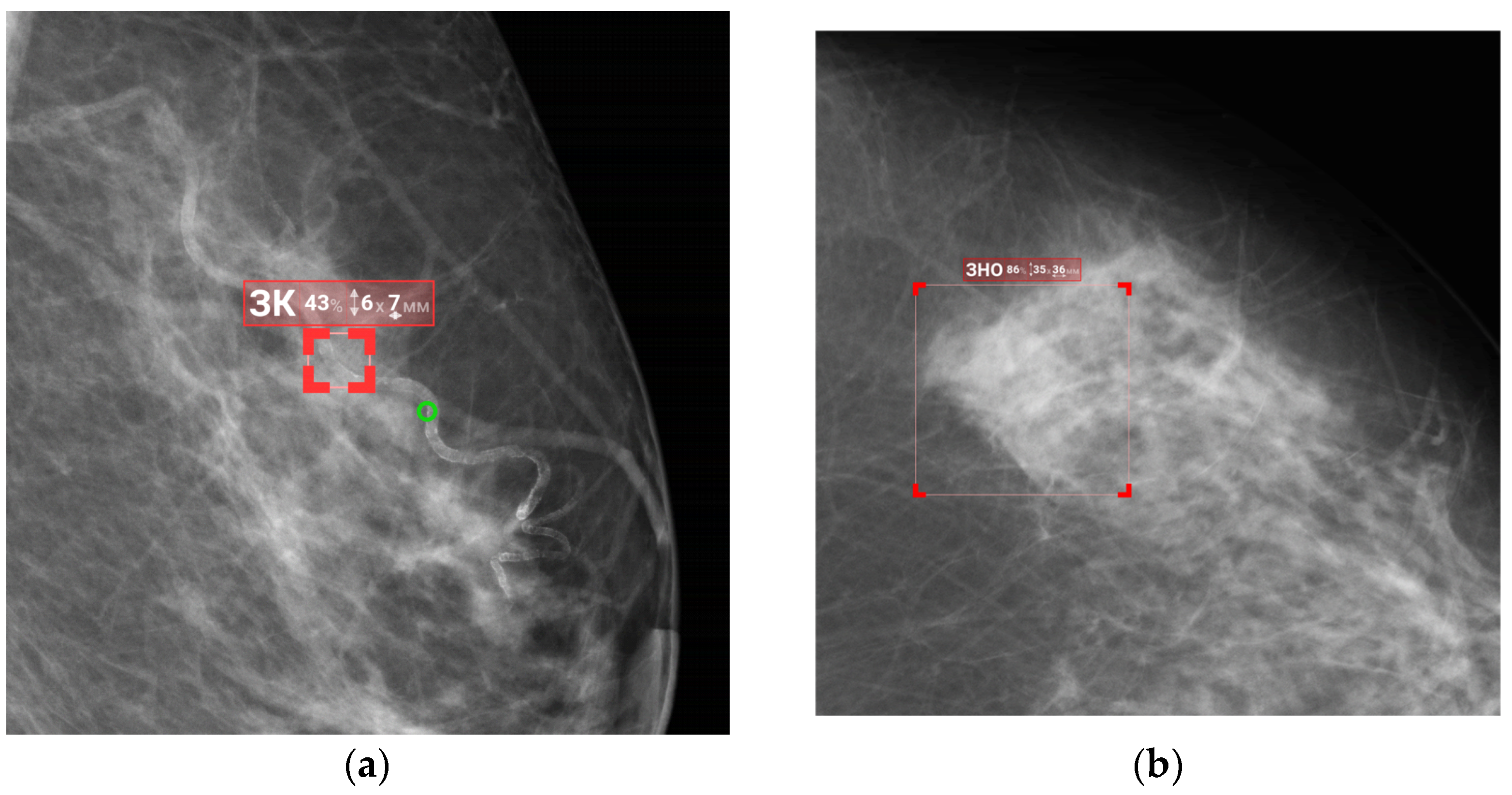 Diagnostics 15 00822 g008
