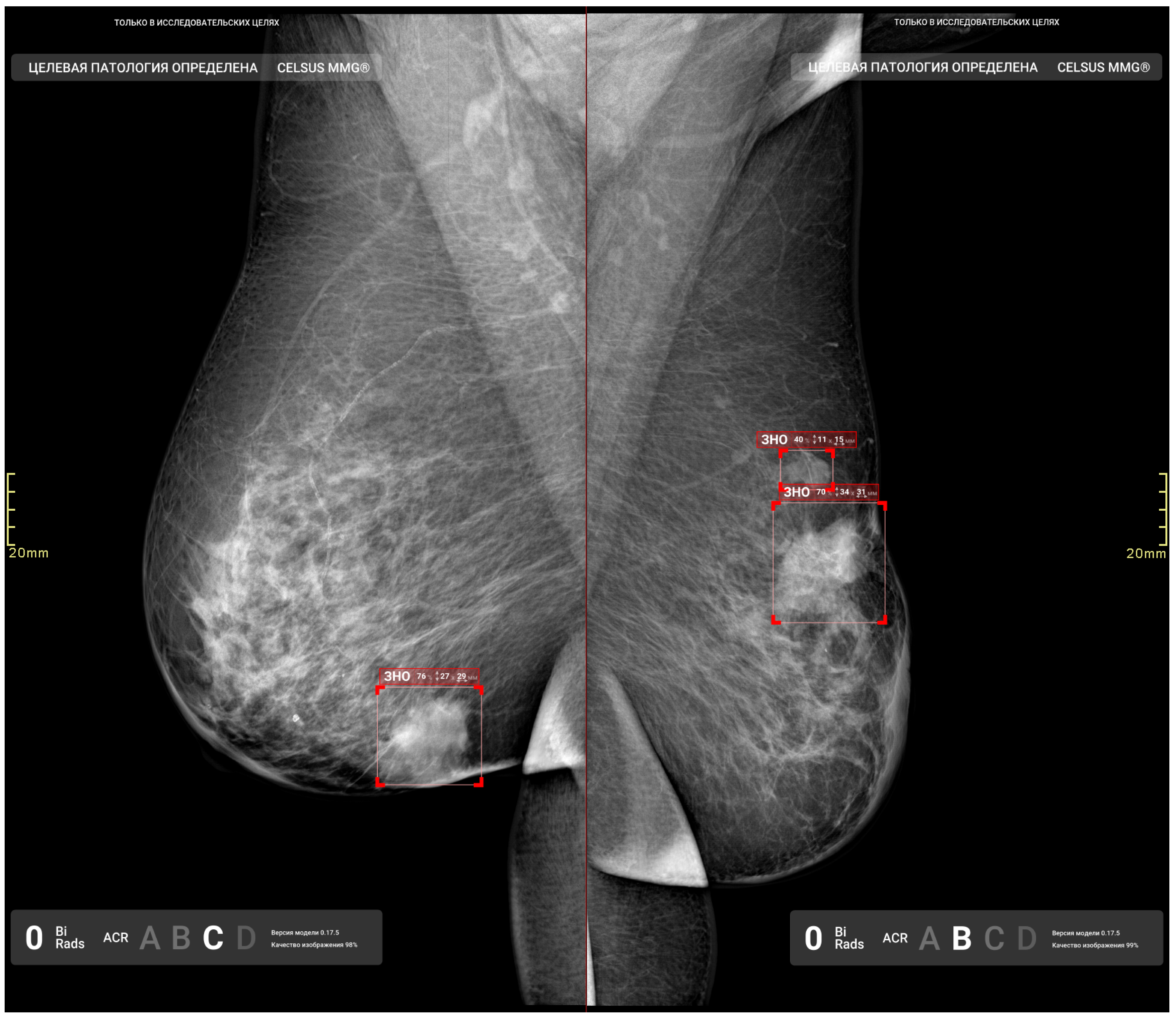 Diagnostics 15 00822 g009