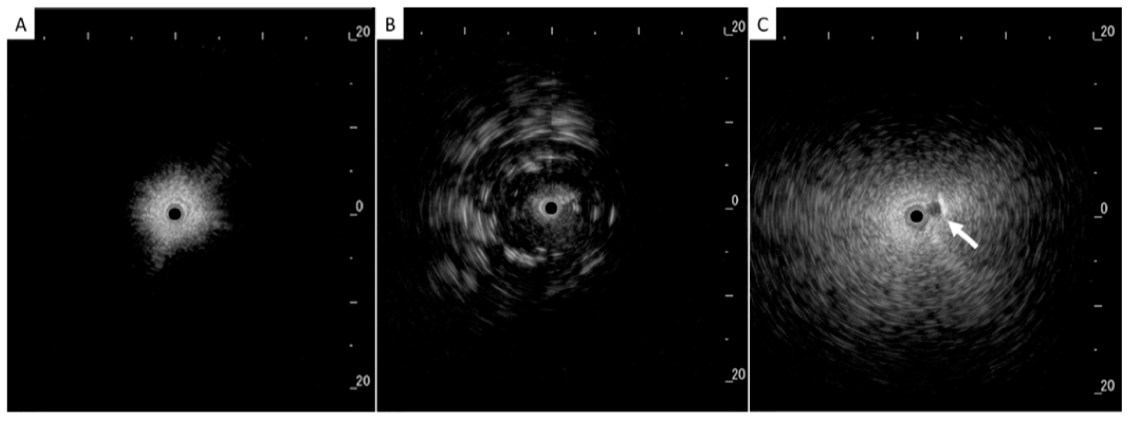 Diagnostics 15 00826 g003