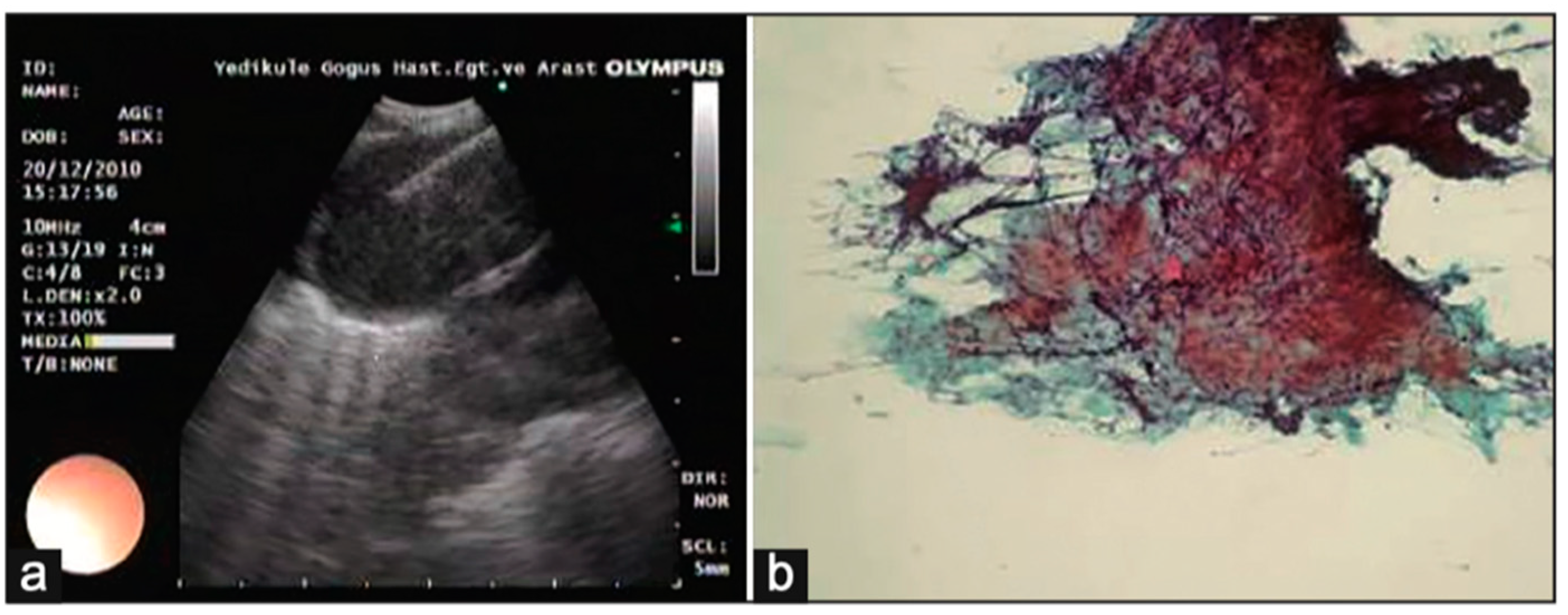 Diagnostics 15 00826 g005