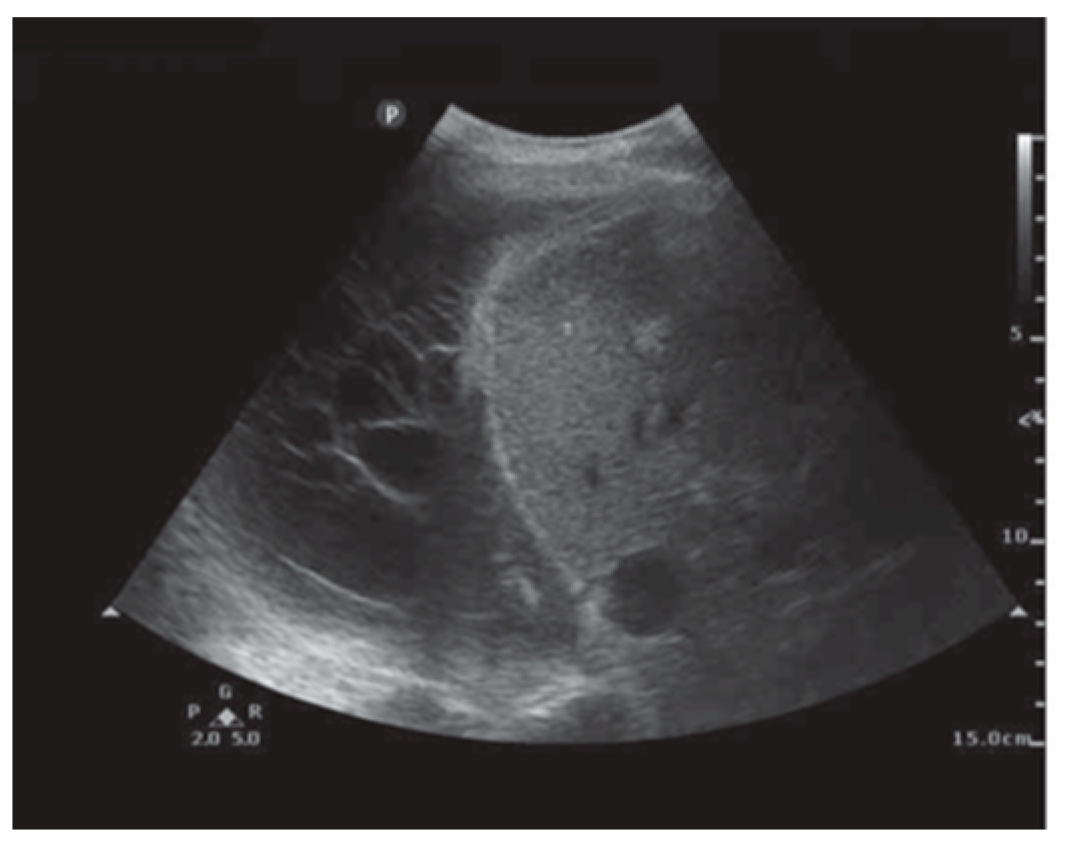 Diagnostics 15 00826 g006
