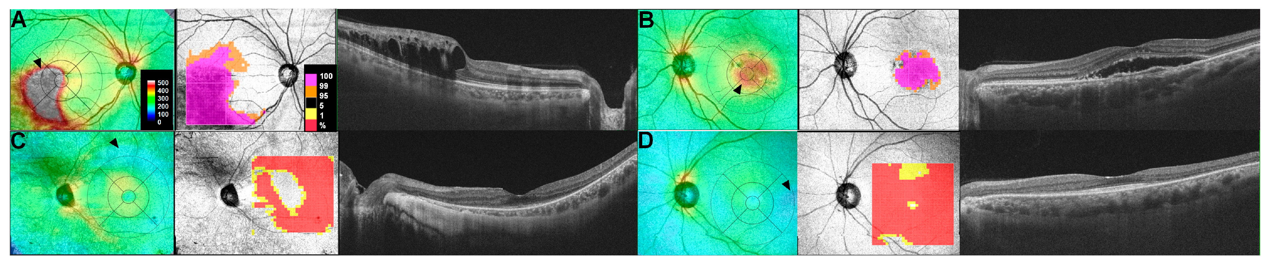 Diagnostics 15 00833 g001 Diagnostics 15 00833 g001