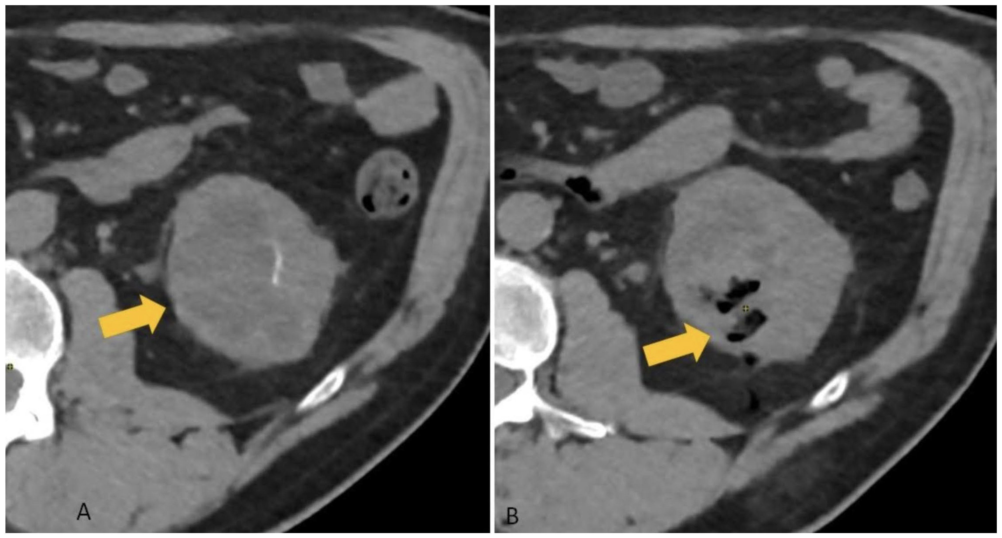 Diagnostics 15 00836 g002