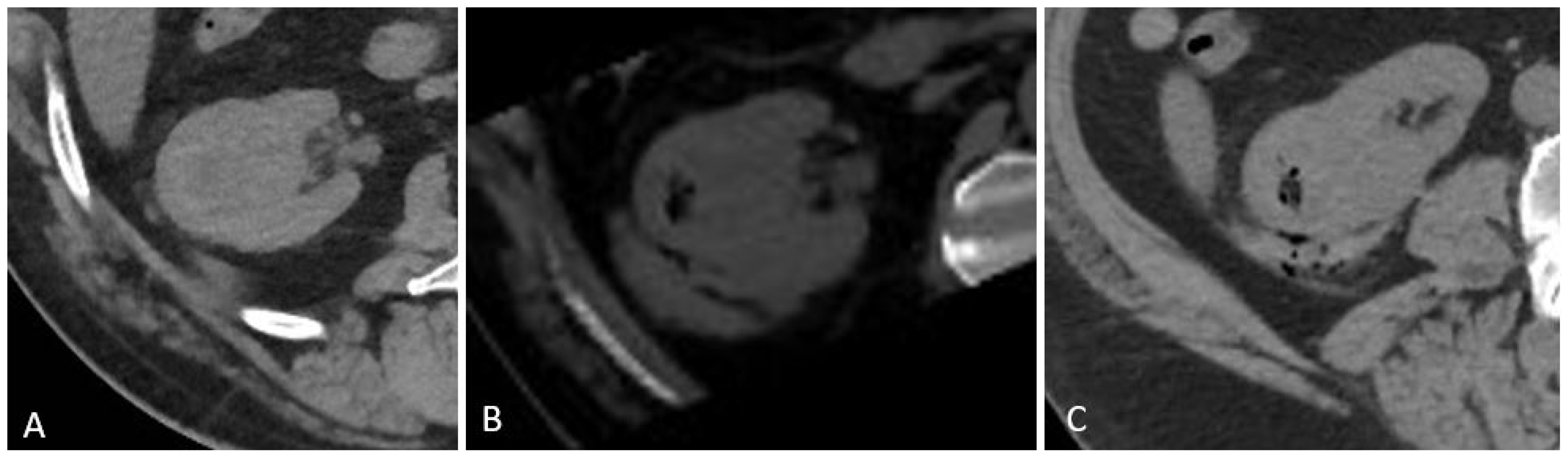 Diagnostics 15 00836 g003