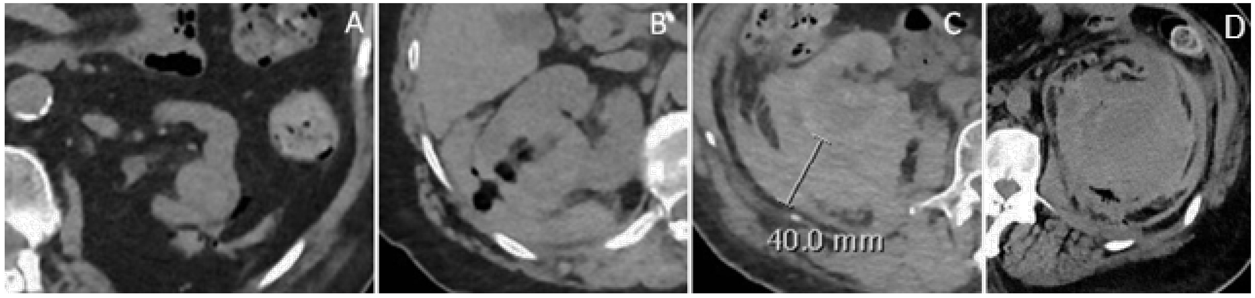 Diagnostics 15 00836 g004