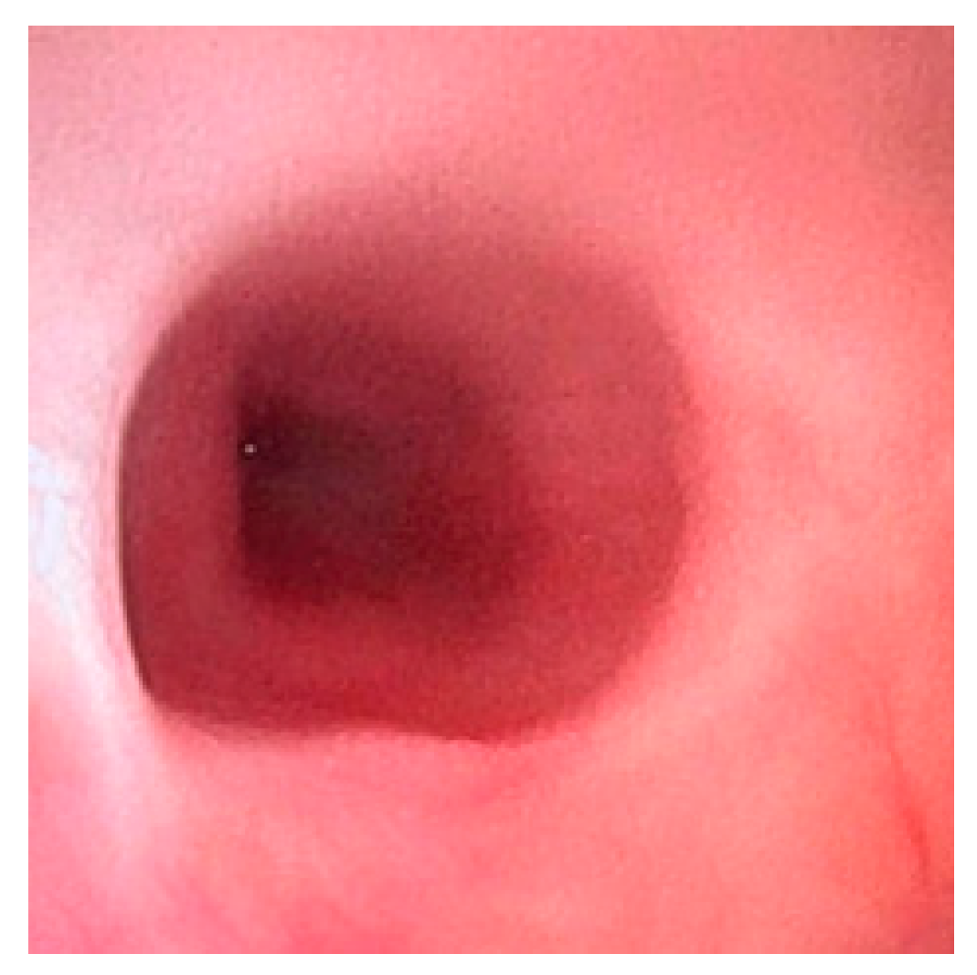 Diagnostics 15 00843 g002