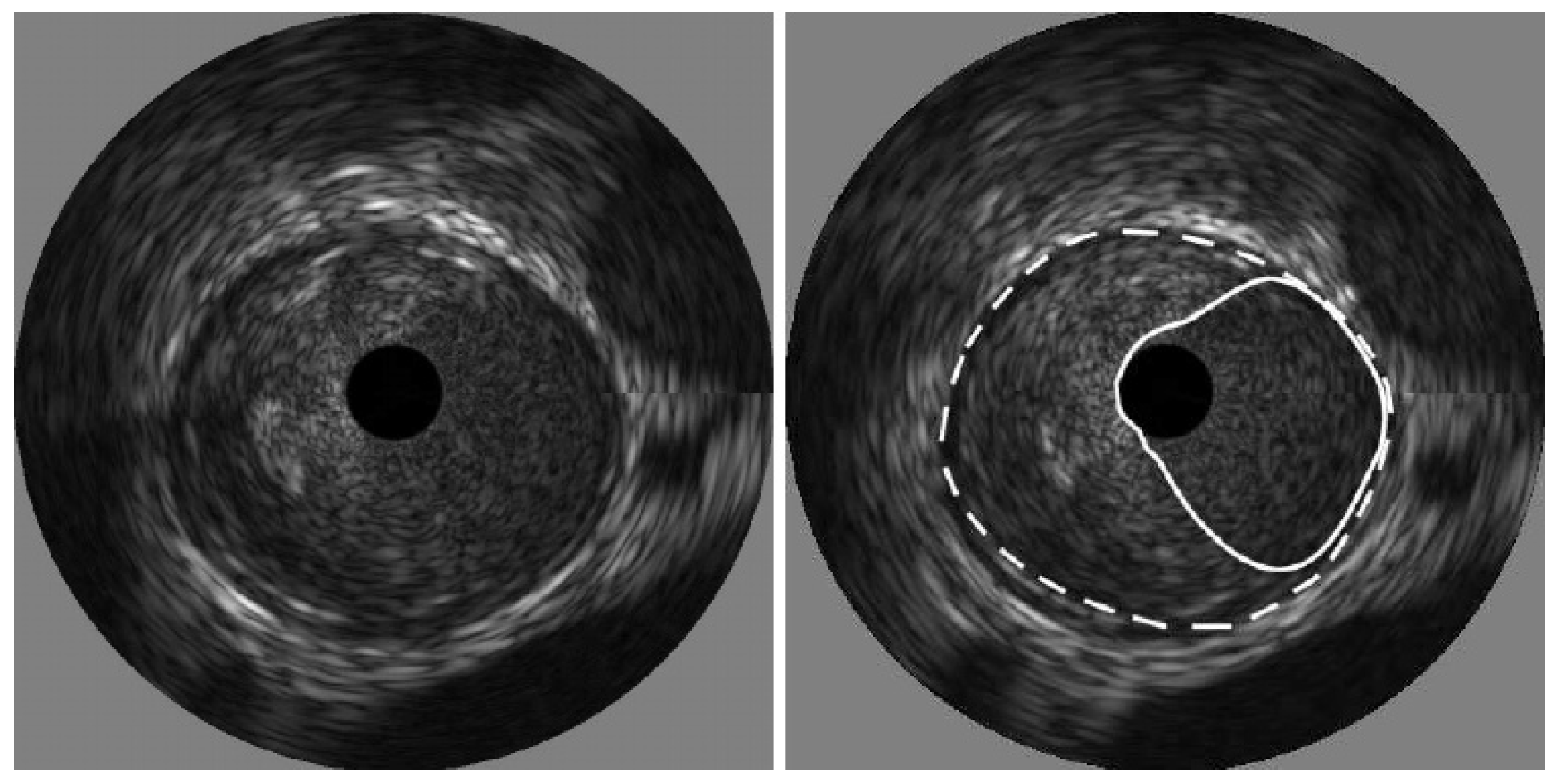 Diagnostics 15 00848 g007