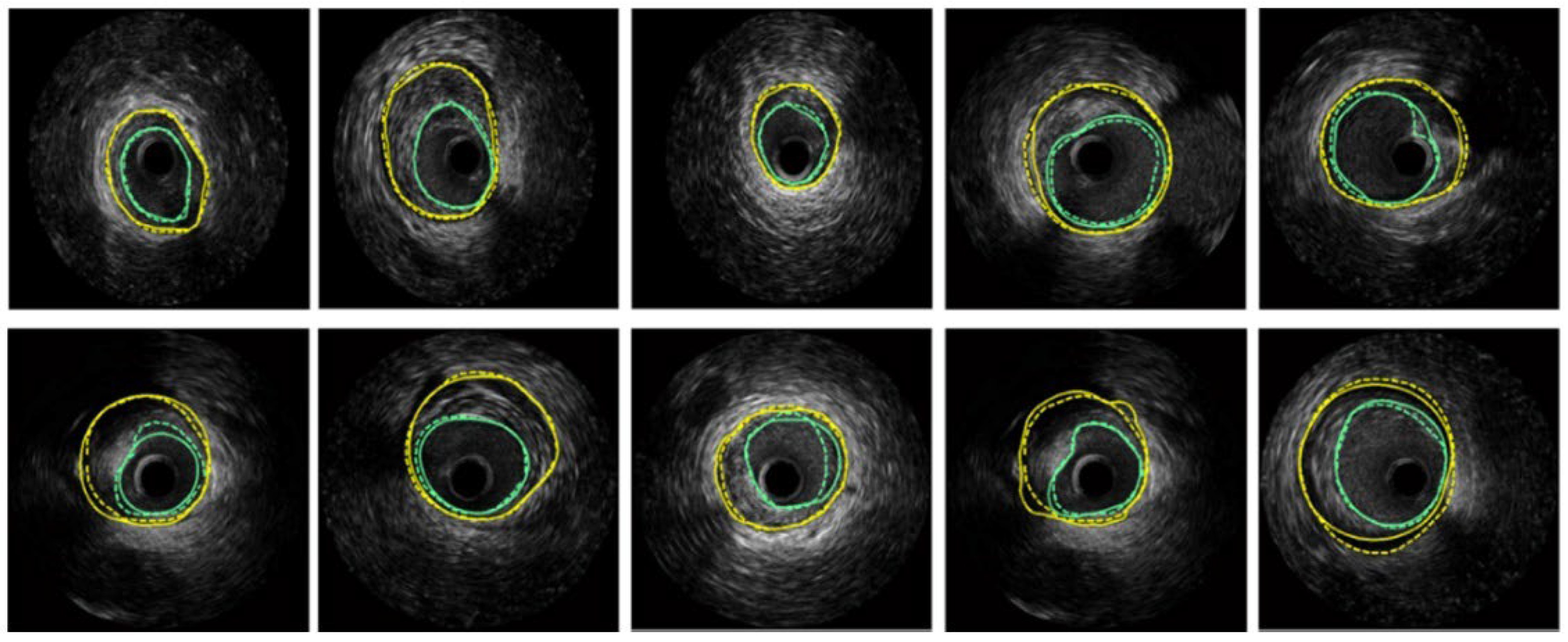 Diagnostics 15 00848 g008