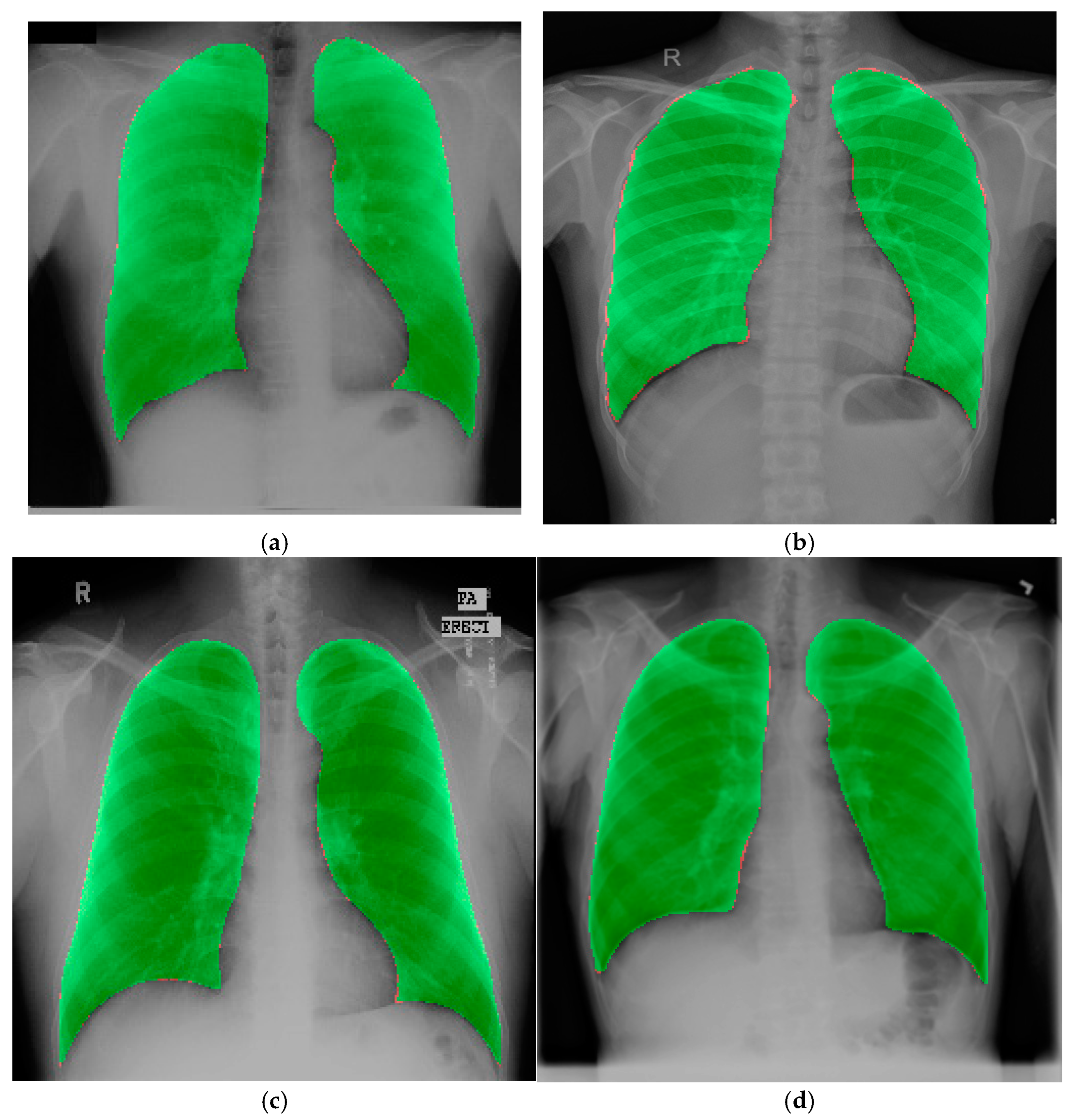 Diagnostics 15 00854 g012