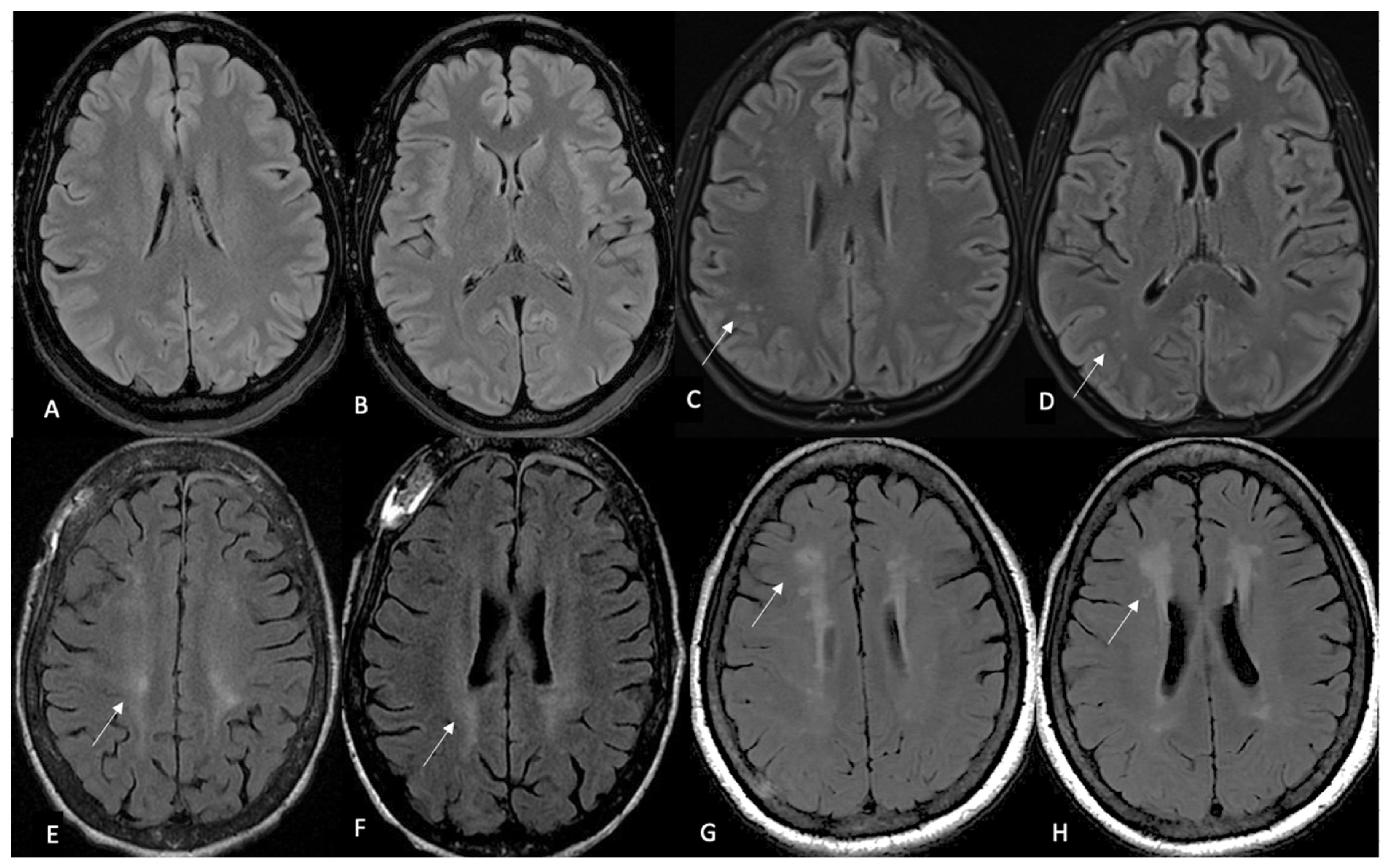 Diagnostics 15 00857 g001
