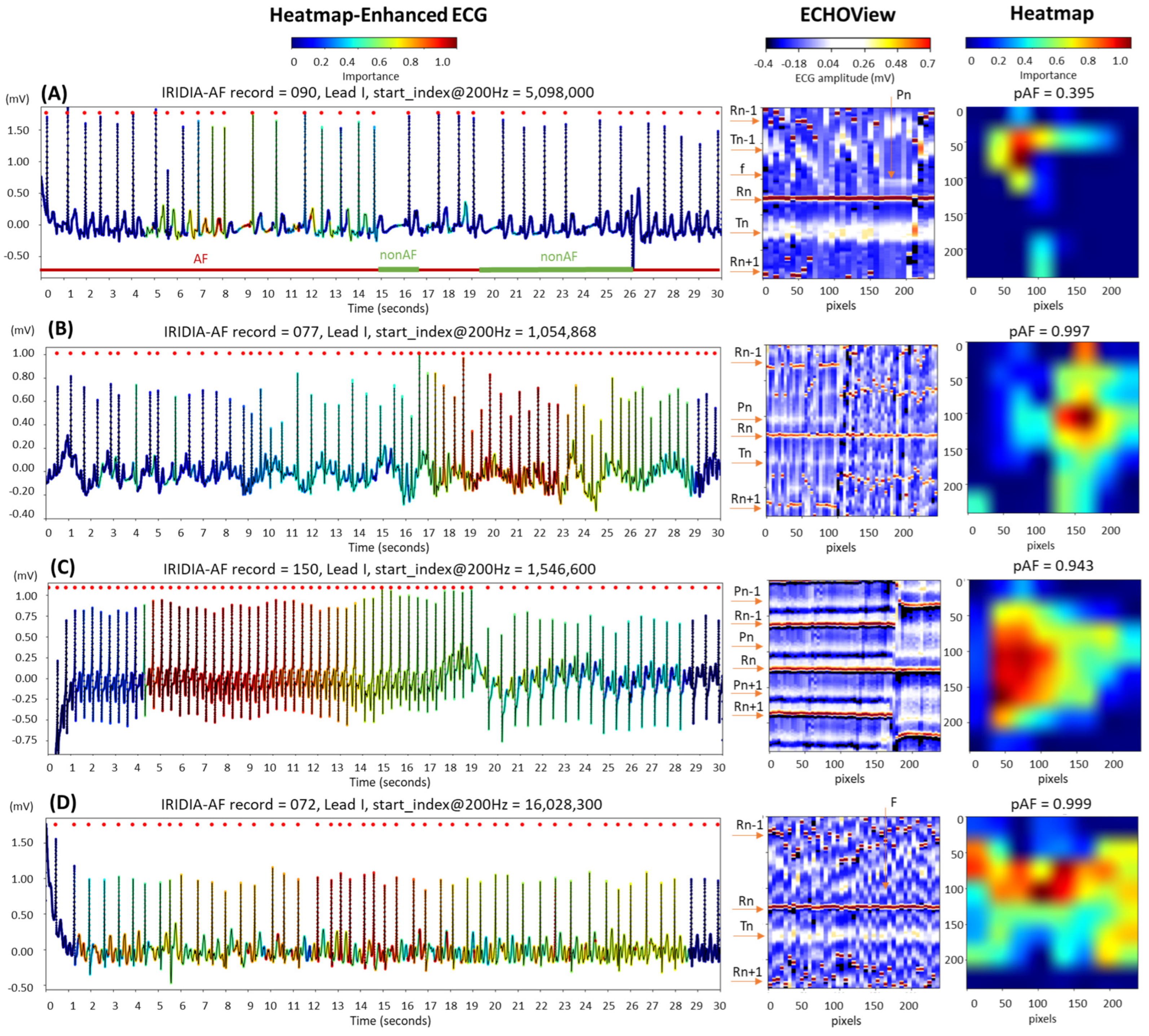 Diagnostics 15 00865 g015