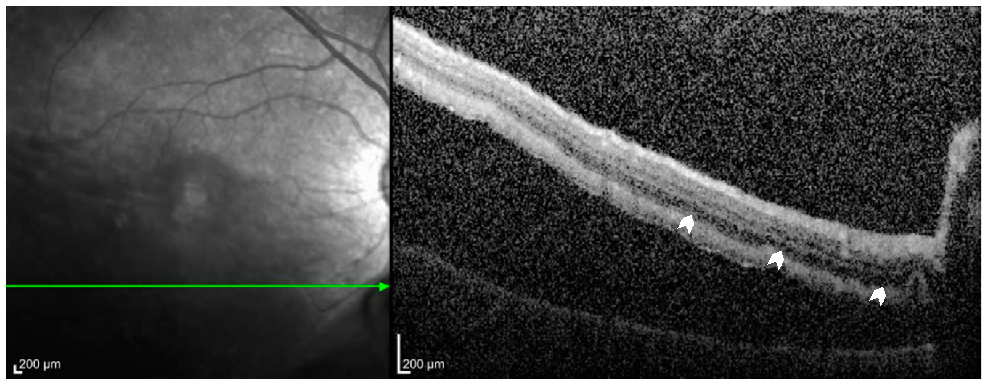 Diagnostics 15 00871 g002