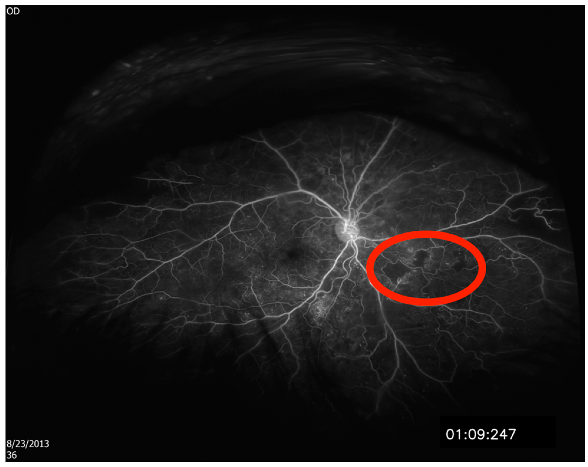 Diagnostics 15 00875 g001