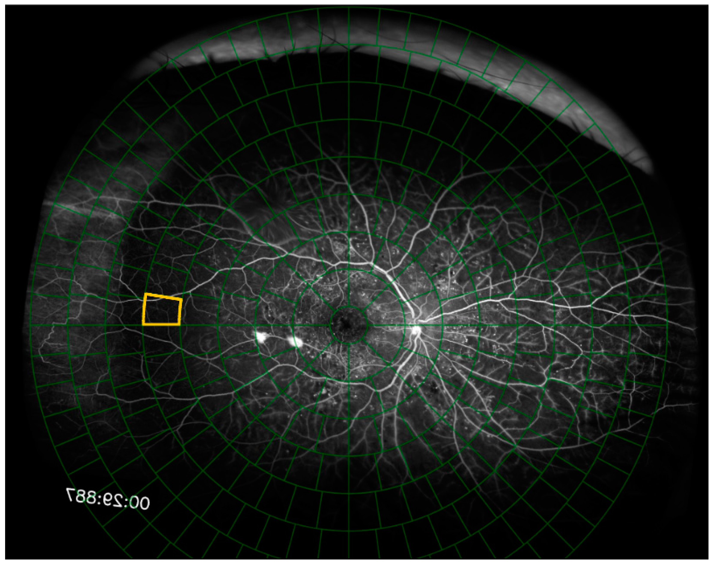 Diagnostics 15 00875 g003