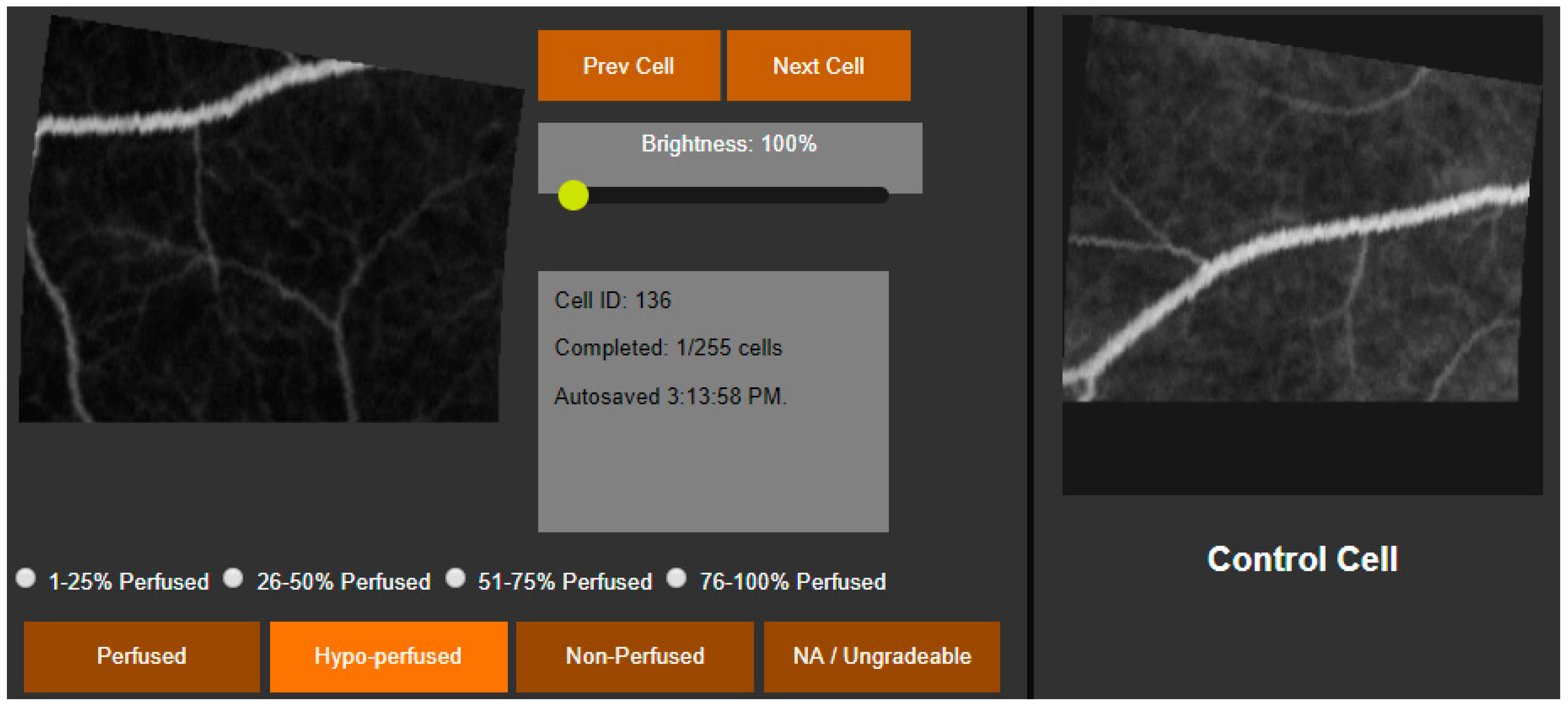 Diagnostics 15 00875 g004