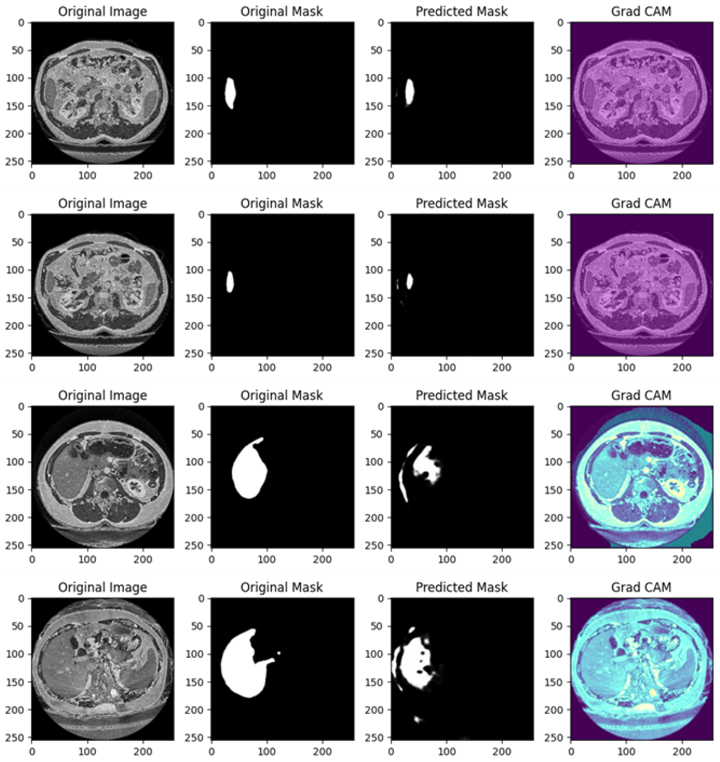Diagnostics 15 00878 g011