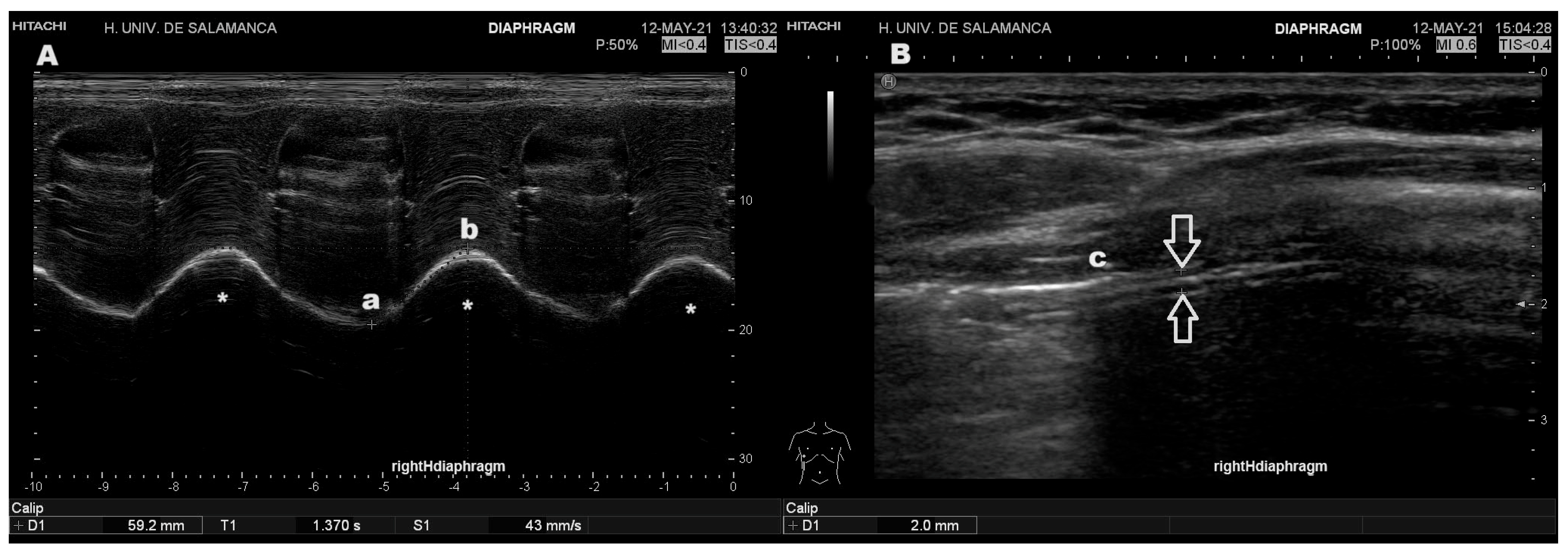 Diagnostics 15 00884 g001