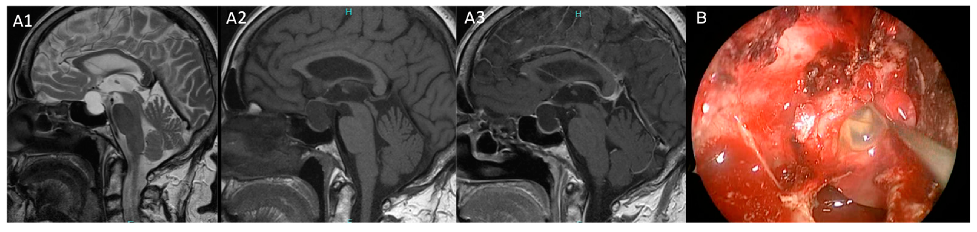 Diagnostics 15 00886 g004