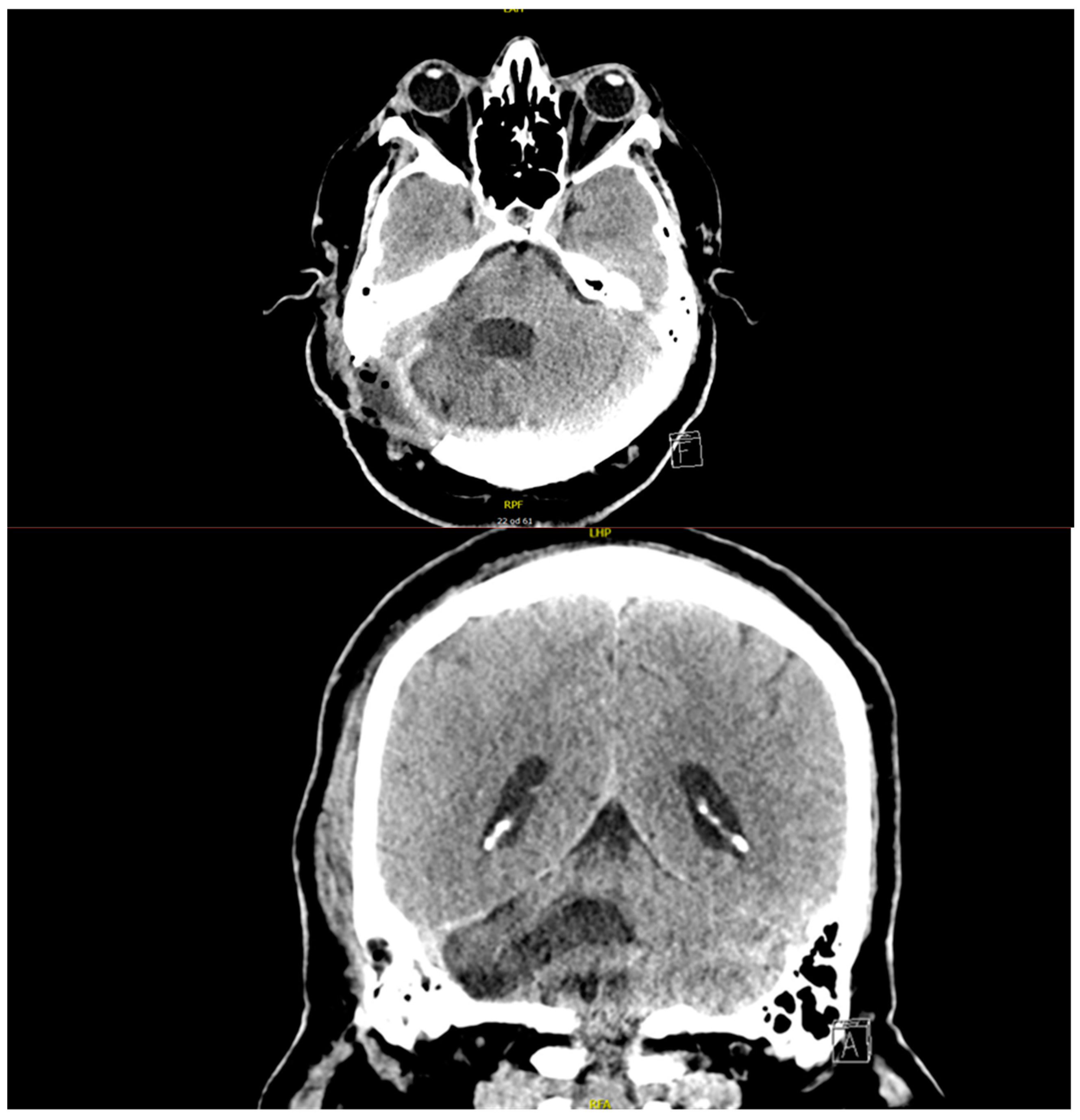 Diagnostics 15 00888 g002