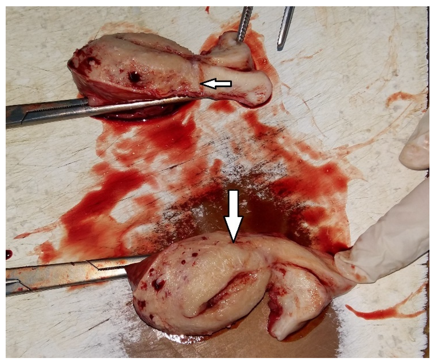 Diagnostics 15 00891 g014