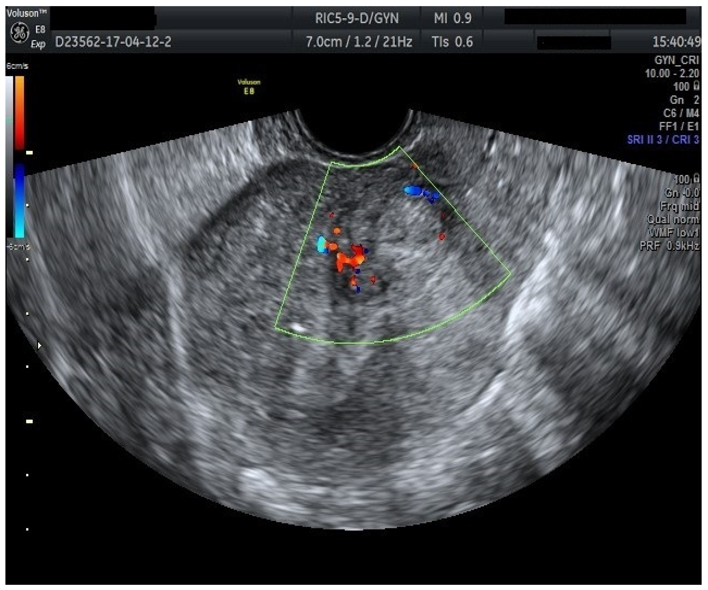 Diagnostics 15 00891 g020