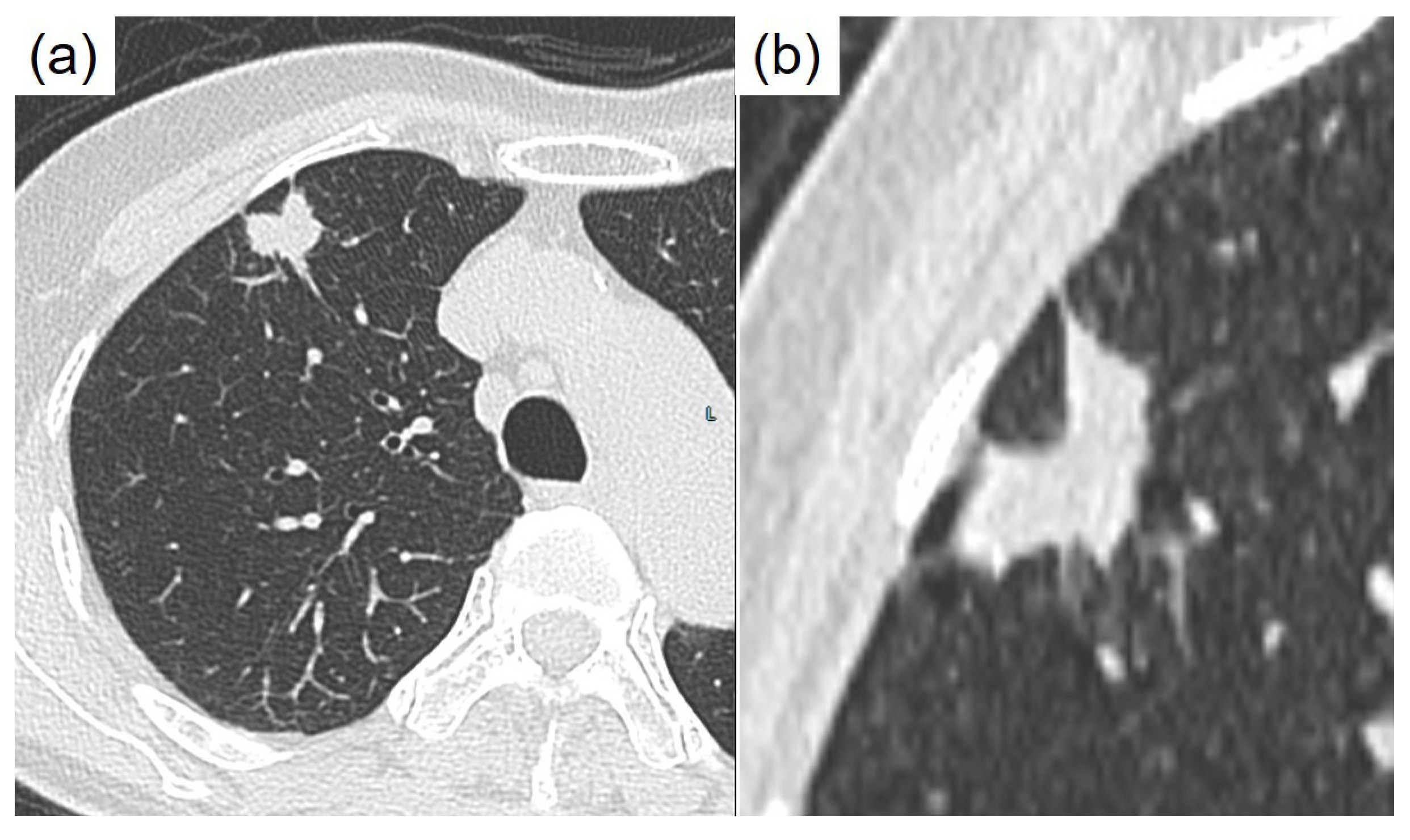 Diagnostics 15 00894 g001
