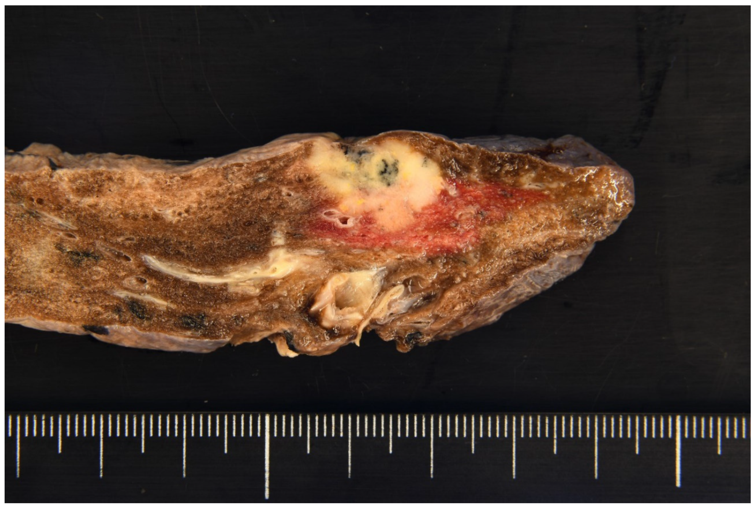 Diagnostics 15 00894 g002