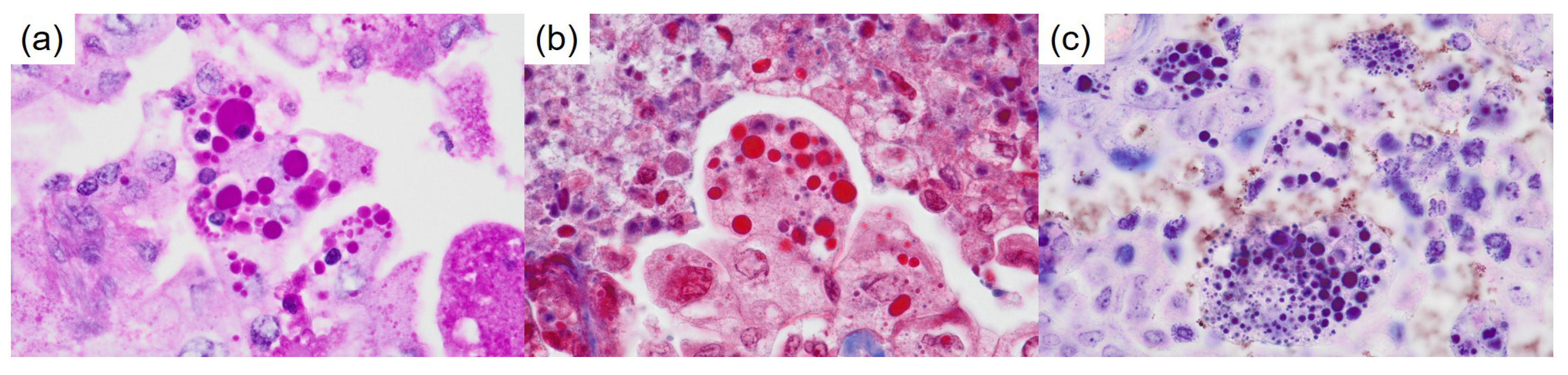 Diagnostics 15 00894 g004