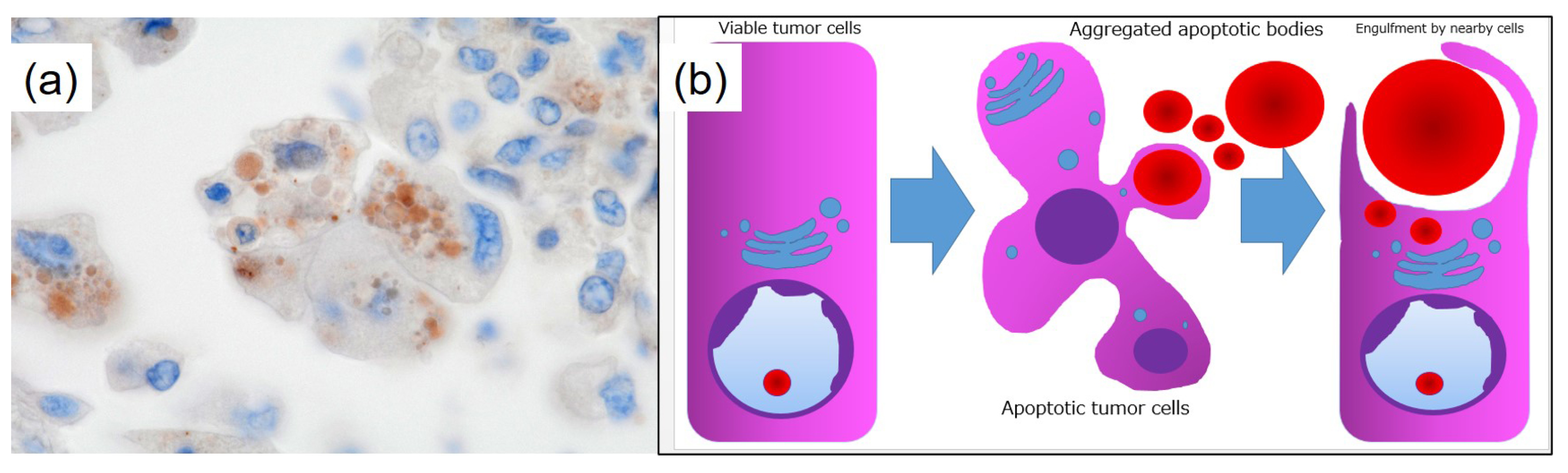 Diagnostics 15 00894 g005