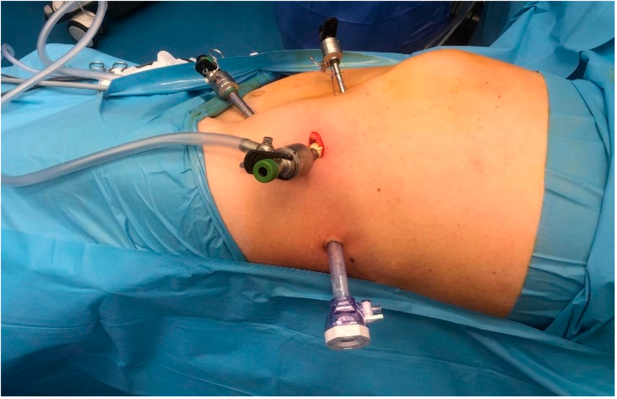 Diagnostics 15 00898 g001 Diagnostics 15 00898 g001