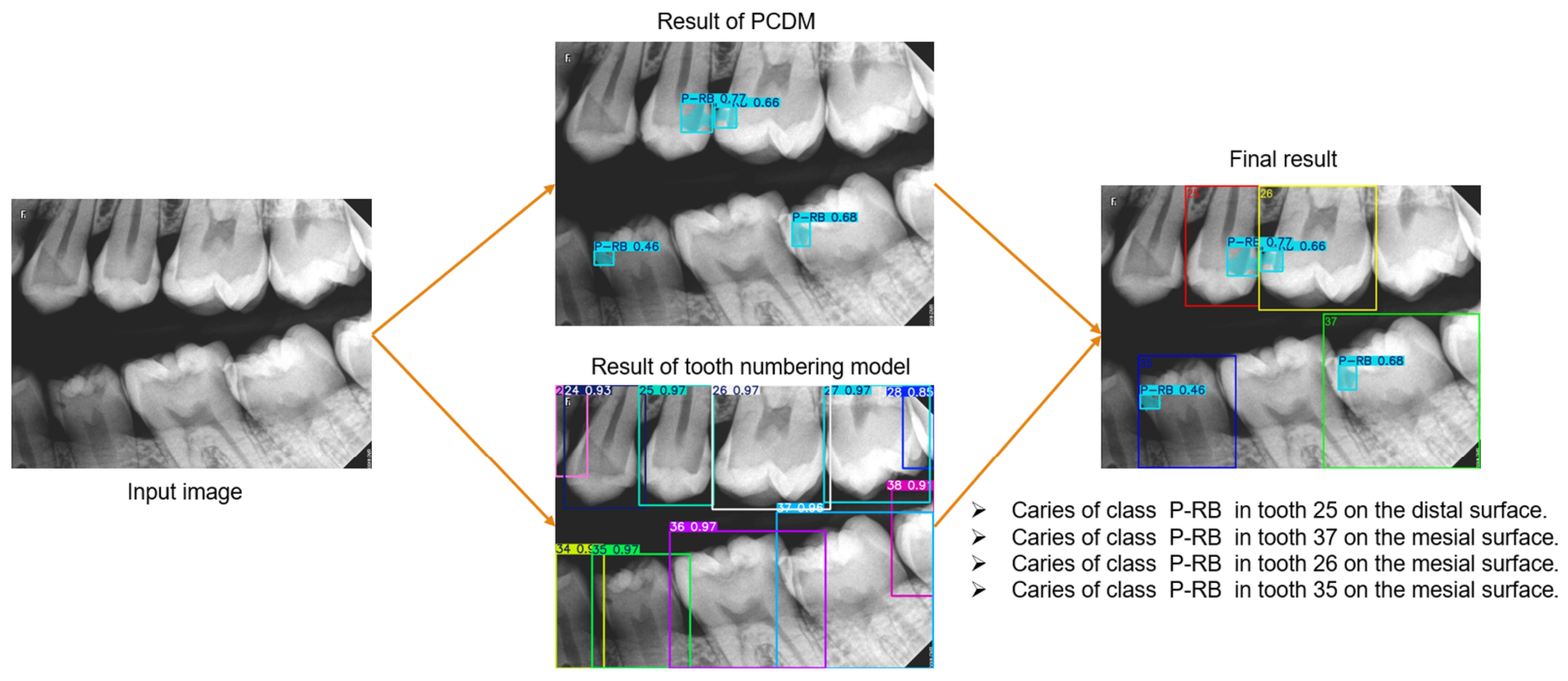 Diagnostics 15 00899 g011